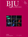 
2008 BJU INTERNATIONAL | 101, 804–808 | doi:10.1111/j.1464-410X.2007.07328.x 
Non-surgical management of multicystic 
dysplastic kidney 
Angelo J. Cambio, Christopher P. Evans and Eric A. Kurzrock 
Department of Urology, University of California, Davis School of Medicine, Sacramento, CA, USA 
Accepted for publication 7 September 2007 
RESULTS 
The inclusion criteria were met by 105 
reports that were subsequently analysed. 
Of MCDK, 60% regress or involute within 
3 years. About 25% of patients will have 
VUR into the contralateral kidney, of 
which 90% is grade 
≤ 
3. The risk of 
urinary tract infection appears to be 
associated with VUR or coexistent 
abnormalities rather than the MCDK. 
The risk of hypertension is no greater 
than that in the general population and 
nephrectomy is usually not curative. 
The overall risk of Wilms’ tumour 
developing in a MCDK is 
< 
1 in 2000. All 
reported Wilms’ tumours were identiﬁed 
before 4 years of age and 70% presented 
as a palpable mass. 
CONCLUSIONS 
Published reports support the non-surgical 
management of MCDK. Common practice has 
been to remove palpable or growing MCDKs, 
although these represent a very small fraction 
of MCDKs. In theory, ultrasonographic 
surveillance until 4 years old might allow the 
earlier detection of a Wilms’ tumour, and 
decrease the intensity of chemotherapy and 
improve prognosis. Previous reports do not 
prove or disprove this concept, and the 
appropriate frequency of surveillance is not 
evident. 
KEYWORDS 
multicystic dysplastic kidney, Wilms’ tumour, 
renal cell carcinoma, vesico-ureteric reﬂux 
OBJECTIVES 
To better deﬁne the outcome and association 
of multicystic dysplastic kidney (MCDK) with 
hypertension, vesico-ureteric reﬂux (VUR), 
infection and cancer, as there is no consensus 
on the management of patients born with 
MCDK. The risk of cancer has dictated the 
surgical management of the disease in 
the past. 
METHODS 
The Medline database was searched for 
articles published between 1965 and 2006 
and written in the English language, and 
containing the keywords ‘multicystic 
dysplastic kidney’. 
INTRODUCTION 
The incidence of multicystic dysplastic kidney 
(MCDK) is not well deﬁned; it is reported to 
occur unilaterally in one in 2400, one in 4100 
or one in 4300 live births, and is the most 
common form of cystic kidney in children 
[1,2]. The condition occurs more commonly in 
males than females (2.4:1) but females are 
twice as likely to have bilateral MCDK. The left 
The incidence of multicystic dysplastic kidney 
(MCDK) is not well deﬁned; it is reported to 
occur unilaterally in one in 2400, one in 4100 
or one in 4300 live births, and is the most 
common form of cystic kidney in children 
[1,2]. The condition occurs more commonly in 
males than females (2.4:1) but females are 
twice as likely to have bilateral MCDK. The left 
kidney is more often affected than the right. 
MCDK has two subtypes that are based 
on gross appearance, i.e. solid cystic 
dysplasia and hydronephrotic form. The 
former is characterized by increased 
stromal components and smaller 
cysts; the hydronephrotic form of MCDK is 
characterized by an identiﬁable renal pelvis. 
Differentiating MCDK from Wilms’ tumour or 
RCC with cystic components is a challenge 
and a potential source of error in reporting 
neoplasia associated with MCDK [3]. 
Recent reports support non-surgical 
management, with long-term follow-up 
[1,4], and there is no strong evidence 
supporting any particular follow-up regimen. 
Current non-surgical management protocols 
might include renal ultrasonography (US), 
growth-chart analysis, urine analysis, blood 
tests and blood pressure assessment, all of 
which are at variable and arbitrary intervals. 
The morbidity and cost of surgery have 
been compared to the morbidity, cost, 
inconvenience and bother of an extended 
follow-up; however, no universally accepted 
management protocol has emerged. After a 
thorough review of published reports in the 
English language, our goal was to present a 
concise statement on the risks and discuss 
management options. 
METHODS 
The Medline database was searched for 
articles published between 1965 and 2006 in 
the English language and containing the 
keywords ‘multicystic dysplastic kidney’. Case 
reports were excluded unless they involved 
cancer. The abstracts of 152 articles were 
analysed and of these, 105 reports were 
reviewed. If an article cited relevant 
original work in report before 1965, 
these were also analysed. We speciﬁcally 
assessed the relationship of MCDK with VUR, 
UTI, hypertension, cancer and the need for 
surgery. 
RESULTS 
DIAGNOSIS 
Previous reports show that historically MCDK 
was a rare ﬁnding that was diagnosed by a 
palpable abdominal mass and managed 
with nephrectomy [5]. The widespread 
use of antenatal US has led to an increasing 
incidence of MCDK [6,7]. Antenatal US has a 
sensitivity of 80–100% with a false-positive 
rate of 
≈ 
2%, the main differential diagnosis 
being a poorly functioning hydronephrotic 
kidney [8,9]. 
Abnormal postnatal US veriﬁes the suspicious 
ﬁnding (Fig. 1). A renal isotope scan is useful 
 
NON-SURGICAL MANAGEMENT OF MULTICYSTIC DYSPLASTIC KIDNEY 
 
© 
 
 
 
2008 THE AUTHORS 
JOURNAL COMPILATION 
 
© 
 
 2008 BJU INTERNATIONAL 
 
805 
 
when the MCDK is not easily distinguished 
from a hydronephrotic kidney. A renal 
concentration of isotope is indicative of 
hydronephrosis, as renal function in MCDK is 
exceedingly rare. If necessary, a DMSA scan is 
appropriate as a diuretic/excretory evaluation 
is unnecessary. 
VUR 
Numerous articles included voiding cysto- 
urethrography (VCUG) in the evaluation of 
MCDK. VUR was reported to occur into the 
contralateral kidney in 15–28% of patients 
[10–14]. Miller 
 
et al. 
 
 [12] retrospectively 
investigated the fate of the reﬂuxing 
contralateral kidney in 75 children with 
MCDK; VUR was diagnosed in 25% of 
patients, with grade distributed as 5% for I, 
42% for II, 42% for III, 11% for IV and none of 
grade V. There was spontaneous resolution 
within 5 years in most (89%) of the patients 
with grade I and II VUR, and half of patients 
with grades III or IV VUR. Of children in this 
series, 19% had a documented UTI at some 
point during the follow-up (median 
53 months). The presence of VUR did not 
correlate with the growth of the normal 
kidney in a child on antimicrobial prophylaxis. 
In 2005, Ismaili 
 
et al. 
 
 [11] challenged the 
routine use of VCUG to detect contralateral 
VUR in patients with a MCDK. In a 
retrospective analysis they reported that two 
successive normal neonatal renal US might 
exclude signiﬁcant contralateral anomalies, 
thus avoiding VCUG and its associated 
radiation exposure and pain. The sensitivity, 
speciﬁcity, positive and negative predictive 
value of two successive neonatal 
ultrasonograms to detect VUR was 75%, 95%, 
80% and 93%, respectively. All patients with 
high-grade VUR were detected by US. Ismaili 
 
et al. 
 
 recommended that VCUG not be used 
in those patients who have two normal 
contralateral postnatal renal ultrasonograms. 
The rate of UTI, with or without antibiotics, 
was not reported, and is a major limitation of 
the study. 
INVOLUTION 
The fate of the affected kidney is variable; 
affected kidneys involute or decrease in size 
in 60–89% of cases, some stay the same 
(2–37%) and few increase in size (0–18%) 
[13,15,16]. The timeline to involution is 
variable; the mean time was reported as 
20 months in one study [13] and 122 months 
in another [16]. Statistically derived estimates 
show that 20% and 50% of MCDKs will 
become undetectable by US (involution) at 3 
and 5 years of follow-up, respectively [17]. 
HYPERTENSION 
Hypertension associated with MCDK has been 
anecdotally reported; the true incidence is 
unknown, but thought to be extremely low. In 
a systematic review of 29 studies, including 
1115 patients, Narchi [18] recently reported 
the incidence of hypertension associated with 
MCDK as 5.4 per 1000 patients. Surprisingly, 
this is lower than the incidence of 
hypertension in the general paediatric 
population. However, Narchi caution that 
their comparison of series was hampered by 
disparities in patient age, follow-up and 
criteria for deﬁning hypertension. In another 
large study, Wacksman and Phipps [19] found 
no cases of hypertension in a series of 441 
cases reported to the Multicystic Kidney 
Registry. Hypertension in a patient with MCDK 
might be an indication for nephrectomy, but 
in about two-thirds of cases the hypertension 
will persist after nephrectomy [20]. 
WILMS’ TUMOUR (WT) 
There were reports on the association of WT 
with MCDK, primarily based on case studies 
and small series (Table 1 [21–28]). Evidence 
supporting these case reports is often 
incomplete and not supported by outside 
pathological review [3]. Despite the nature of 
this evidence, the purported increased risk of 
cancer continues to dictate the management 
of MCDK for many urologists. Many patients 
have had and continue to have nephrectomies 
[29]. 
In response to this issue, Beckwith [3] 
calculated the risk of WT in MCDK, based on 
work by Gordon 
 
et al. 
 
 [2], in which 10 
unilateral cases of MCDK were detected in 
43 175 live births, thereby estimating an 
incidence of 1 in 4300 live births. The National 
Wilms’ Tumor Study Pathology Center 
provided data on 7500 WTs collected over 
26 years; only ﬁve of the 7500 WTs occurred 
in a MCDK. The risk of WT in the general 
population is 1 in 8000–10 000. Taking into 
account the risk of MCDK during the same 
26-year period, the calculated risk of WT in 
association with MCDK is 1 in 2000. With a 
90% cure rate for WT, Beckwith concluded 
that nephrectomy and routine monitoring are 
not justiﬁed [3]. 
Surprisingly, through a completely different 
approach, Noe 
 
et al. 
 
 [30] had previously 
calculated that 2000 nephrectomies would be 
necessary to prevent one WT. Nephrogenic 
rests are a precursor to WT and the incidence 
is 
 
≈ 
 
1% in the general population, or 
 
≈ 
 
100 
times the incidence of WT. The incidence of 
nephrogenic rests in those with WT is higher, 
at 12–40% [31], and in those with MCDK is 
reported to be to 3–5% [31]. Assuming 1% of 
cases of nephrogenic rests degenerate to WT 
[31] and there is a 5% increased risk of 
nephrogenic rests with MCDK, 2000 
nephrectomies would be needed to prevent 
one WT [30]. The calculation by Noe 
 
et al. 
 
 
supports the estimate generated by 
Beckwith [3]. 
In the Preliminary Report of the Multicystic 
Kidney Registry, Wacksman and Phipps [19] 
report only two cases of WT in the 25 years 
before their 1993 publication. A 10-month- 
old and 4-year-old both presented with a 
palpable mass. Of the 260 cases of MCDK in 
the registry that were managed without 
surgery, there were no cases of WT. The 
Multicystic Kidney Registry stopped enrolling 
patients in the late 1990s, but only one 
patient in 
 
≈ 
 
900 cases registered developed a 
malignancy, and this malignancy did not 
develop in a true MCDK (J Wacksman, 
personal communication 2006). Wacksman 
and Phipps [19] estimate that 8000 MCDKs 
would have to be removed to prevent one 
tumour. 
In a systematic review of 26 studies including 
1041 patients, Narchi [32] reported that there 
were no WTs in patients with MCDK. While 
the results from this systematic review 
are promising, the author noted that the 
study was limited by heterogeneity of the 
populations, an 18-year span of studies and 
availability/accuracy of antenatal US, the 
varied duration of follow-up and varied 
 
FIG. 1. 
 
An ultrasonogram of a MCDK.
 
CAMBIO 
 
ET AL. 
 
© 
 
 
 
2008 THE AUTHORS 
 
806 
 
JOURNAL COMPILATION 
 
© 
 
 2008 BJU INTERNATIONAL 
 
frequency of US surveillance. Nevertheless, 
there is no large review or meta-analysis 
reporting an association of MCDK with WT. 
In our review of 10 reported cases of WT 
associated with a purported MCDK (Table 1), 
seven presented with a palpable abdominal 
mass. No patient with documented WT 
presented after 4 years of age; only four had a 
known history of MCDK, and none presented 
with metastatic disease. Survival data were 
available for eight of the 10 cases. The follow- 
up ranged from 7 months to 12 years and no 
recurrences or deaths were reported. There 
were no reports of WT associated with an 
involuted kidney. 
RCC 
We found six reports of RCC associated with 
MCDK in patients aged 15–44 years; all cases 
were of advanced stage with large tumours. 
The accuracy of the pathological diagnosis of 
MCDK with these large tumours is debatable. 
None were subject to outside pathological 
review, as with WT. None of the patients had a 
pre-existing history of MCDK. As such, it is 
possible that some of these were cystic RCCs. 
 
DISCUSSION 
 
Before antenatal US was routinely used 
most identiﬁed MCDKs were large and 
palpable. This abnormal ﬁnding on physical 
examination led to the preferred treatment of 
nephrectomy. In the era of antenatal US the 
prevalence of MCDK has increased and the 
size of affected kidneys has decreased [5]. 
High rates of spontaneous partial or complete 
involution [1,13,15–17] and low rates of 
hypertension [18] and neoplasia [32] have 
shifted the management to a non-surgical 
approach. 
There is little controversy about the diagnostic 
evaluation of MCDK. The argument for 
VCUG in patients with MCDK parallels the 
controversy and rhetoric about infants with 
pre- and postnatal mild hydronephrosis; VUR 
is found in 15–40% of these infants [33]. 
Evidence suggests that the ﬁnding of low- 
grade VUR might not be clinically important 
[33]. Unlike infants with prenatal 
hydronephrosis, children with MCKD have 
half the renal reserve. The recognition of 
reﬂux and prevention of pyelonephritis in 
children with a solitary functioning kidney is 
important. Cystography is still practised 
routinely, as reported in the vast majority of 
published series. 
Some authors include urine culture and blood 
pressure assessment as components of the 
follow-up for MCDK. Urine culture in children 
carries an inherent rate of false-positive 
results. The preliminary report of the 
Multicystic Registry reported only 12 cases of 
UTI in the 260 cases that were managed 
without surgery [19]. Similar to the 
management of VUR, routine urine culture in 
asymptomatic children is hampered by a 
signiﬁcant false-positive rate, which negates 
its value. Paediatricians recommend blood 
pressure monitoring in all children during 
clinical encounters after the age of 3 years. 
Children aged 
 
< 
 
3 years should have their 
blood pressure measured under special 
circumstances, such as MCDK [34]. 
Complete involution, meaning that the MCDK 
has become imperceptible to US, is a 
satisfying outcome. However, the malignant 
potential of even small amounts of residual 
tissue is uncertain. In our review we were 
unable to ﬁnd one case of WT associated with 
an involuted MCDK. All cases of WT presented 
before 4 years old and at least seven of the 10 
were palpable. These are new ﬁndings from 
our review. No deaths from WT were reported. 
Two investigators, with different methods, 
have calculated the risk of developing a WT to 
be 1 in 2000 for children with MCDK (the risk 
in the general paediatric population is 1 in 
8–10 000). 
An estimated 36 000 new cases of RCC were 
diagnosed in the USA in 2005. Considering 
the higher incidence of RCC in men and the 
higher incidence of MCDK in newborn boys, 
there should be 
 
≈ 
 
10 random associations of 
RCC with MCDK per year. As there are only six 
reported in the English language, MCDK 
 
TABLE 1 
 
Case reports of Wilms’ tumour associated with MCDK 
 
Reference 
Age*, 
months/sex Presentation Outcome 
[21] 18/M Prenatal US showing renal cysts; L ﬂank mass on physical exam; conﬁrmed by 
postnatal US; 14 months persistent cystic disease with no evidence of tumour; 
4 months later parent noticed increasing abdominal girth; 16 
 
× 
 
10 
 
× 
 
13 cm solid 
tumour with calciﬁcations; L total nephrectomy; favourable histology WT with 
invasion into perirenal fat 
Chemo for 6 months NED 13 month f/u 
[22] 11/M Prenatal diagnosis MCDK, lost to f/u, 11 months presented with abdominal mass Positive response to chemo f/u NR 
[23] 5/F Prenatal diagnosis of MCDK, abdominal swelling NED 6 year f/u 
3/F L ﬂank mass on US Chemo; NED 8 year f/u 
[24] 17/M MCDK discovered on MRI when evaluating anorectal malformation NR 
[25] 5/NR Nephrectomy for abnormal sonogram NED, 1 year f/u 
[26] 48/F Palpable abdominal mass NR 
[27] 10/M Palpable abdominal mass NED, 11 year f/u 
[28] 9/F Palpable abdominal mass NED, 5 year f/u 
1/M Palpable abdominal mass NED, 5 month f/u 
 
f/u, follow-up; L, left, NED, no evidence of disease; NR, not reported; chemo, chemotherapy. *Age at diagnosis of growing abdominal mass that prompted surgical 
intervention.
 
NON-SURGICAL MANAGEMENT OF MULTICYSTIC DYSPLASTIC KIDNEY 
 
© 
 
 
 
2008 THE AUTHORS 
JOURNAL COMPILATION 
 
© 
 
 2008 BJU INTERNATIONAL 
 
807 
 
might carry an equal or lesser risk of 
developing RCC than a normal kidney. 
In urological reports, proponents of surgery 
argue that non-surgical management 
requires a long-term follow-up with frequent, 
costly US, leaving patients at risk of infection, 
hypertension and cancer, especially in those 
cases lost to follow-up. A few studies showed 
that early nephrectomy is more cost-effective 
than non-surgical follow-up. These types 
of analyses are arbitrary, as the necessary 
frequency of US surveillance is unknown 
and costs are highly variable among health 
systems. This surgical bias is absent in the 
nephrological literature. 
There are various and similar surveillance 
regimens used for MCDK. Generally, these 
include renal US every 3–6 months for the 
ﬁrst year, every 6 months in the second year 
and then annually thereafter. The main 
indication for frequent surveillance is to 
detect WT. The prognosis after treating WT 
depends on the stage and histology at surgery. 
Children with lower stage disease (I, II) have an 
excellent 4-year recurrence-free survival 
( 
 
≈ 
 
95%) compared to higher-stage disease (III, 
IV; 
 
≈ 
 
85%) for both the National WT Study 
Group and the Société Internationale 
d’Oncologie Pédiatrique protocols. More 
important than stage is tumour histology; 
children with stage I and unfavourable 
histology (anaplasia) have a signiﬁcantly 
lower overall survival (83%) than children 
with stage I and favourable histology (98%). 
Although time and growth will inevitably 
increase the stage, there is no evidence that 
time does or does not affect histology. 
There are disorders that have a well 
documented association with WT, i.e. 
Beckwith–Wiedmann syndrome (BWS) and 
idiopathic hemihypertrophy (IHH). As WTs 
grow so rapidly, experience with screening 
children with BWS/IHH has shown that US is 
needed every 3–4 months to effectively lower 
the tumour stage [35,36]. Notably, in the 
screened population, 20% of children had 
false-positive results and thus had surgery for 
benign lesions. Frequent surveillance is not 
recommended after 6 years of age in the 
BWS/IHH population. The incidence of WT in 
these patients ( 
 
≈ 
 
5%) is 100 times higher than 
the theoretical incidence (0.05%) of WT in 
patients with MCDK. 
How does the risk of WT compare with other 
childhood malignancies? The incidence of 
WT, brain cancer and leukaemia per million 
children per year is 8, 33 and 44, respectively; 
the last two cancers are signiﬁcantly more 
deadly. Unfortunately, there is no economic, 
noninvasive manner to screen all children for 
these grave cancers. As the incidence of 
MCDK is only 1 in 4000, there is a small at-risk 
population who can be screened. Fortunately, 
US is relatively inexpensive and not invasive. 
Beyond cancer screening, surveillance of 
these kidneys is advantageous as some will 
grow. What has not been answered is the 
appropriate frequency of surveillance. If the 
goal is to down-stage a WT, a 4-month 
frequency until age 4 years would be 
necessary. 
In conclusion, the incidence of MCDK is 
 
≈ 
 
1 in 
4000 live births, of which 60% will regress or 
involute within 3 years. Up to a third of 
patients will have VUR into the contralateral 
kidney, of which 90% is grade I–III. The risk of 
UTI appears to be associated with VUR or 
coexistent urological abnormalities rather 
than the MCDK. The risk of hypertension is no 
greater than that in the general population 
and nephrectomy is usually not curative. The 
overall risk of WT developing in a MCDK is 
 
< 
 
1 
in 2000. All reported WTs were identiﬁed 
before 4 years of age and seven of 10 
presented as a palpable mass. There is no 
reported case of WT in association with an 
involuted MCDK. As such, the risk of WT 
developing in an MCDK which is regressing 
or involuted is substantially 
 
< 
 
1 in 2000, 
and is probably less than the risk of 
neoplasia in a normal size kidney. There 
is no evidence to support an increased risk 
of RCC with MCDK. 
Previous reports support the non-surgical 
management of MCDK. Although not 
supported by ﬁrm published evidence, the 
common practice has been to remove 
palpable or growing MCDKs; however, such 
cases are rare. The increased risk of WT 
supports surveillance with US up to 4 years 
old, but there is no evidence to guide the 
appropriate frequency of renal imaging. 
 
ACKNOWLEDGEMENTS 
 
We appreciate the input and review 
of this manuscript before submission by 
J. Bruce Beckwith, MD. Angelo Cambio, 
MD, was supported by the Aventis 
Clinical Research Fellowship in Urologic 
Oncology. 
 
CONFLICT OF INTEREST 
 
None declared. 
 
REFERENCES 
 
1 
 
Kuwertz-Broeking E, Brinkmann OA, 
Von Lengerke HJ 
 
et al. 
 
 Unilateral 
multicystic dysplastic kidney: experience 
in children. 
 
BJU Int 
 
 2004; 
 
93 
 
: 388–92 
2 
 
Gordon AC, Thomas DF, Arthur RJ, 
Irving HC. 
 
Multicystic dysplastic kidney: 
is nephrectomy still appropriate? 
 
J Urol 
 
 
1988; 
 
140 
 
: 1231–4 
3 
 
Beckwith JB. 
 
Wilms tumor and 
multicystic dysplastic kidney disease. 
Editorial Comment. 
 
J Urol 
 
 1997; 
 
158 
 
: 
2259–60 
4 
 
Rickwood AM, Anderson PA, Williams 
MP. 
 
Multicystic renal dysplasia detected 
by prenatal ultrasonography. Natural 
history and results of conservative 
management. 
 
Br J Urol 
 
 1992; 
 
69 
 
: 538–40 
5 
 
Bloom DA, Brosman S. 
 
The multicystic 
kidney. 
 
J Urol 
 
 1978; 
 
120 
 
: 211–5 
6 
 
Eckoldt F, Woderich R, Smith RD, 
Heling KS. 
 
Antenatal diagnostic aspects 
of unilateral multicystic kidney dysplasia 
– sensitivity, speciﬁcity, predictive values, 
differential diagnoses, associated 
malformations and consequences. 
 
Fetal 
Diagn Ther 
 
 2004; 
 
19 
 
: 163–9 
7 
 
Mandell J, Paltiel HJ, Peters CA, 
Benacerraf BR. 
 
Prenatal ﬁndings 
associated with a unilateral 
nonfunctioning or absent kidney. 
 
J Urol 
 
 
1994; 
 
152 
 
: 176–8 
8 
 
Bhide A, Sairam S, Farrugia MK, Boddy 
SA, Thilaganathan B. 
 
The sensitivity of 
antenatal ultrasound for predicting renal 
tract surgery in early childhood. 
 
Ultrasound Obstet Gynecol 
 
 2005; 
 
25 
 
: 
489–92 
9 
 
Eckoldt F, Woderich R, Wolke S, Heling 
KS, Stover B, Tennstedt C. 
 
Follow-up of 
unilateral multicystic kidney dysplasia 
after prenatal diagnosis. 
 
J Matern Fetal 
Neonatal Med 
 
 2003; 
 
14 
 
: 177–86 
10 
 
Flack CE, Bellinger MF. 
 
The multicystic 
dysplastic kidney and contralateral 
vesicoureteral reﬂux: protection of the 
solitary kidney. 
 
J Urol 
 
 1993; 
 
150 
 
: 1873–4 
11 
 
Ismaili K, Avni FE, Alexander M, 
Schulman C, Collier F, Hall M. 
 
Routine 
voiding cystourethrography is of no value 
in neonates with unilateral multicystic 
dysplastic kidney. 
 
J Pediatr 
 
 2005; 
 
146 
 
: 
759–63 
12 
 
Miller DC, Rumohr JA, Dunn RL, Bloom 
 
CAMBIO 
 
ET AL. 
 
 
 
 
 
 
 
 
DA, Park JM. 
 
What is the fate of the 
reﬂuxing contralateral kidney in children 
with multicystic dysplastic kidney? 
 
J Urol 
 
 
2004; 
 
172 
 
: 1630–4 
13 
 
Rottenberg GT, Gordon I, De Bruyn R. 
 
The natural history of the multicystic 
dysplastic kidney in children. 
 
Br J Radiol 
 
 
1997; 
 
70 
 
: 347–50 
14 
 
Selzman AA, Elder JS. 
 
Contralateral 
vesicoureteral reﬂux in children with a 
multicystic kidney. 
 
J Urol 
 
 1995; 
 
153 
 
: 
1252–4 
15 
 
Heymans C, Breysem L, Proesmans 
W. 
 
Multicystic kidney dysplasia: a 
prospective study on the natural history 
of the affected and the contralateral 
kidney. 
 
Eur J Pediatr 
 
 1998; 
 
157 
 
: 673–5 
16 
 
Rabelo EA, Oliveira EA, Diniz JS 
 
et al. 
 
 
Natural history of multicystic kidney 
conservatively managed: a prospective 
study. 
 
Pediatr Nephrol 
 
 2004; 
 
19 
 
: 1102–7 
17 
 
Rabelo EA, Oliveira EA, Silva GS, 
Pezzuti IL, Tatsuo ES. 
 
Predictive factors 
of ultrasonographic involution of 
prenatally detected multicystic dysplastic 
kidney. 
 
BJU Int 
 
 2005; 
 
95 
 
: 868–71 
18 
 
Narchi H. 
 
Risk of hypertension with 
multicystic kidney disease: a systematic 
review. 
 
Arch Dis Child 
 
 2005; 
 
90 
 
: 921–4 
19 
 
Wacksman J, Phipps L. 
 
Report of the 
Multicystic Kidney Registry: preliminary 
ﬁndings. 
 
J Urol 
 
 1993; 
 
150 
 
: 1870–2 
20 
 
Husmann DA. 
 
Renal dysplasia: the risks 
and consequences of leaving dysplastic 
tissue in situ. 
 
Urology 
 
 1998; 
 
52 
 
: 533–6 
21 
 
de Oliveira-Filho AG, Carvalho MH, 
Sbragia-Neto L, Miranda ML, Bustorff- 
Silva JM, de Oliveira ER. 
 
Wilms tumor in 
a prenatally diagnosed multicystic kidney. 
 
J Urol 
 
 1997; 
 
158 
 
: 1926–7 
22 
 
Minevich E, Wacksman J, Phipps L, 
Lewis AG, Sheldon CA. 
 
The Importance 
of accurate diagnosis and early close 
followup in patients with suspected 
multicystic dysplastic kidney. 
 
J Urol 
 
 1997; 
 
158 
 
: 1301–4 
23 
 
Homsy YL, Anderson JH, Oudjhane K, 
Russo P. 
 
Wilms tumor and multicystic 
dysplastic kidney disease. 
 
J Urol 
 
 1997; 
 
158 
 
: 2256–9 
24 
 
Oddone M, Marino C, Sergi C 
 
et al. 
 
 
Wilms’ tumor arising in a multicystic 
kidney. 
 
Pediatr Radiol 
 
 1994; 
 
24 
 
: 
236–8 
25 
 
Dimmick JE, Johnson HW, Coleman GU, 
Carter M. 
 
Wilms tumorlet, nodular renal 
blastema and multicystic renal dysplasia. 
J Urol 1989; 142: 484–5 
26 Hartman GE, Smolik LM, Shochat SJ. 
The dilemma of the multicystic dysplastic 
kidney. Am J Dis Child 1986; 140: 925– 
8 
27 Raffensperger J, Abousleiman A. 
Abdominal masses in children under on 
year of age. Surgery 1968; 63: 514–21 
28 Uson AC, Del Rosario C, Melicow MM. 
Wilms tumor in association with cystic 
renal disease: report of two cases. J Urol 
1960; 83: 262–6 
29 Elder JS, Hladky D, Selzman AA. 
Outpatient nephrectomy for 
nonfunctioning kidneys. J Urol 1995; 154: 
712–4 
30 Noe HN, Marshall JH, Edwards OP. 
Nodular renal blastema in the multicystic 
kidney. J Urol 1989; 142: 486–8 
31 Beckwith JB. The John Lattimer lecture. 
Wilms tumor and other renal tumors of 
childhood: an update. J Urol 1986; 136: 
320–4 
32 Narchi H. Risk of Wilms’ tumour with 
multicystic kidney disease: a systematic 
review. Arch Dis Child 2005; 90: 147–9 
33 Yerkes EB, Adams MC, Pope J, Ct 
Brock JW 3rd. Does every patient with 
prenatal hydronephrosis need voiding 
cystourethrography? J Urol 1999; 162: 
1218–20 
34 Anonymous National High Blood 
Pressure Education Program Working 
Group on High Blood Pressure in 
Children and Adults. The fourth report 
on the diagnosis, evaluation, and 
treatment of high blood pressure in 
children and adolescents. Pediatrics 2004; 
114: 555–76 
35 Choyke PL, Siegel MJ, Craft AW, Green 
DM, DeBaun MR. Screening for Wilms 
tumor in children with Beckwith– 
Wiedemann syndrome or idiopathic 
hemihypertrophy. Med Pediatr Oncol 
1999; 32: 196–200 
36 Hoyme HE, Seaver LH, Jones KL, 
Procopio F, Crooks W, Feingold M. 
Isolated hemihyperplasia 
(hemihypertrophy): report of a 
prospective multicenter study of the 
incidence of neoplasia and review. Am J 
Med Genet 1998; 79: 274–8 
Correspondence: Eric A. Kurzrock, Department 
of Urology, 4860 Y St., Suite 3500, 
Sacramento, CA 95817, USA. 
e-mail: 
 <script language='JavaScript' type='text/javascript'>
 <!--
 var prefix = 'ma' + 'il' + 'to';
 var path = 'hr' + 'ef' + '=';
 var addy15888 = 'eric.kurzrock' + '@';
 addy15888 = addy15888 + 'ucdmc' + '.' + 'ucdavis' + '.' + 'edu';
 document.write( '<a ' + path + '\'' + prefix + ':' + addy15888 + '\'>' );
 document.write( addy15888 );
 document.write( '<\/a>' );
 //-->\n </script><script language='JavaScript' type='text/javascript'>
 <!--
 document.write( '<span style=\'display: none;\'>' );
 //-->
 </script>This email address is being protected from spam bots, you need Javascript enabled to view it
 <script language='JavaScript' type='text/javascript'>
 <!--
 document.write( '</' );
 document.write( 'span>' );
 //-->
 </script> 
Abbreviations: MCDK, multicystic dysplastic 
kidney; US, ultrasonography; VCUG, voiding 
cysto-urethrography; WT, Wilms’ tumour; 
BWS, Beckwith–Wiedmann syndrome; IHH, 
idiopathic hemihypertrophy.