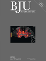 Pathological variants of invasive bladder cancer according
to their suggested clinical significance
Antonio Lopez-Beltran, Maria J. Requena*, Liang Cheng†‡ and Rodolfo Montironi¶
Departments of Pathology and *Urology, Reina Sofia University Hospital and Cordoba University Medical School,
Cordoba, Spain, †Pathology and ‡Urology, Indiana University School of Medicine, Indianapolis, USA, and ¶Institute of
Pathological Anatomy and Histopathology, Polytechnic University of the Marche Region, Ancona, Italy
Accepted for publication 27 July 2007
pathologists and urologists to be aware of the
diverse morphological patterns in invasive
bladder cancer, as they might be relevant in
patient management and prognosis, mainly
because they can mimic benign lesions,
secondary tumours or might require a specific
therapeutic approach
KEYWORDS
bladder, neoplasms, pathological variant,
urothelial carcinoma
Several pathological variants of bladder
cancer, reflecting tumour heterogeneity in
urothelial carcinoma, have been recently
recognized. In this review we summarize the
most common pathological variants of
urothelial carcinoma, with an emphasis on
clinical implications. It is important for both
INTRODUCTION
Urothelial carcinoma (UC) is a heterogeneous
tumour with a great propensity for divergent
differentiation, resulting in a urothelial
carcinoma admixed with other
morphologically recognisable components [1].
The most common mixed differentiation is
squamous, in
≈
20% of urothelial bladder
carcinomas, followed by glandular, that can
reach up to 6% of cases in some series [1–5].
As seen in Table 1, virtually the whole
spectrum of bladder carcinoma variants can
be seen in variable proportions from an
otherwise typical UC, but most importantly,
these variants can be relevant in clinical
practice, as they might simulate benign
lesions, secondary tumours, or necessitate a
more complex therapeutic approach beyond
surgery [1,6]. Recent studies suggest an
increasing likelihood of lymph node
metastases associated with the finding of
pathological variants in the primary tumour
[7]. Recognising these variants is therefore
clinically relevant in patient management.
UC WITH DECEPTIVELY
BENIGN APPEARANCE
NESTED VARIANT
The nested variant of UC is an aggressive
neoplasm with fewer than 50 reported cases
[1,8–10]. There is a male predominance, and
70% of patients died 4–40 months after
diagnosis, despite therapy [9,11]. This rare
pattern of UC was first described as a tumour
with a ‘deceptively benign’ appearance that
closely resembles Brunn’s nests infiltrating
the lamina propria [8,12–14]. Nuclei generally
show little or no atypia, but the invariable
presence of an infiltrative growth should
facilitate an accurate diagnosis. In terms of
biology, there is high p53 accumulation and
tumour cell proliferation, findings that are
useful in difficult cases [1]. Despite the
deceptively benign appearance of the tumour,
recently it was proposed to grade this as
high-grade, to assist the urologist in selecting
the appropriated therapy [1].
UC WITH ENDOPHYTIC GROWTH (INVERTED
PAPILLOMA-LIKE CARCINOMA)
The recent interest in UC with endophytic
growth arose because they can be
misdiagnosed as a benign inverted papilloma
[1,15–18]. This is because inverted papillomalike
carcinoma can show variable-to-minimal
cytological and architectural abnormalities,
but invariably has a higher mitotic count and
cell proliferation, as seen by Ki67, high p53
accumulation, aberrant cytokeratin 20
expression, and frequent polysomies at
chromosome 3, 9 and 17 [19]. This profile has
been very useful in the differential diagnosis
with inverted papilloma [18,19]. In some
instances, both inverted papilloma and
inverted papilloma-like carcinoma are
intimately mixed [18]. The other important
feature in papillary tumours with endophytic
growth is that they invade the lamina propria
with a ‘pushing’ border [20]. Unless this
pattern is accompanied by true destructive
stromal invasion, the likelihood of metastasis
is minimal because the basement membrane
is not truly breached [15].
UC WITH FEATURES SUGGESTING
SECONDARY INVOLVEMENT TO
THE BLADDER
MICROPAPILLARY UC
This variant of UC was initially described
because it resembles papillary serous
carcinoma of the ovary [1,21]. This
morphology has been further recognized in
other organs such as lung, colon, breast, renal
pelvis or salivary glands [1,22]. A recent report
based on 100 consecutive cases treated by
cystectomy showed a mean patient age of
64.7 years, with a male: female ratio of 10 : 1
[22]. The stage at the time of presentation was
Ta in five patients, carcinoma
in situ
in four, T1
in 35, T2 in 26, T3 in seven, T4 in six; N
+
in
nine and M
+
in eight. The 5- and 10-year
overall survival rates were 51% and 24%,
respectively. Intravesical BCG therapy was
attempted in 27 of 44 patients with nonmuscle-
invasive disease; 18 (67%) developed
disease progression (
≥
cT2), including 22%
who developed metastatic disease [22]. Of 55
L O P E Z - B E L T R A N
E T A L .
©
2 0 07 T H E A U T H O R S
2 7 6
J O U R N A L C O M P I L A T I O N
©
2 0 07 B J U I N T E R N A T I O N A L
patients undergoing radical cystectomy for
surgically resectable disease (
≤
cT4a), 23
received neoadjuvant chemotherapy and 32
were treated with initial cystectomy, with no
significant difference in stage distribution
between the groups. For the 23 patients
treated with neoadjuvant chemotherapy, the
median overall survival was 43.2 months, with
32% of patients still alive at 5 years [22].
For the 32 patients treated with initial
cystectomy, the median survival had not been
reached at the time of the last follow-up, with
71% still alive at 5 years. It was concluded
that micropapillary bladder cancer is
associated with a poor prognosis, that
intravesical therapy appears to be ineffective
in this disease, and patients with surgically
resectable disease should be offered early
radical cystectomy [22]. Also, increased lymph
node positivity was associated with the
presence of micropapillary carcinoma in
a recent study [7,23].
At histology, the micropapillary component
is found in association with noninvasive
papillary or invasive UC in 80% of
reported cases [1]; 25% show glandular
differentiation, and some authors consider
it as a variant of adenocarcinoma.
Vascular and lymphatic invasion is common,
and most cases show invasion into
muscularis propria or deeper, often with
metastases at the time of diagnosis [24].
Immunohistochemical studies show
immunoreactivity for epithelial markers,
similar to conventional UC in all, and CA125
staining in 43% of cases [25]. The presence
of a surface micropapillary component in
bladder biopsy specimens is a useful clue for
further investigation, and an indication for
deeper biopsies to determine the level of
invasion. In addition to stage, the prognosis
seems to be related to the proportion and
location of the micropapillary component
[10,25]. Cases with a moderate or extensive
micropapillary component are at high risk of
having an advanced stage at presentation.
Cases with
<
10% micropapillary component
have a high chance of detection at an early
stage.
PLASMACYTOID UC
This is an unusual variant in which the
tumour cells show eosinophilic cytoplasm and
eccentric nuclei, producing a plasmacytoid
appearance, thus suggesting multiple
myeloma/lymphoma [1,6,10,26]. The epithelial
nature of the malignancy is confirmed
by positive immunohistochemistry of
cytokeratin and negativity for lymphoma/
plasmacytoma markers. This tumour is an
aggressive neoplasm with a stage-related
outcome and frequent lymph node positivity
at diagnosis [27]. In a series report of six cases,
the male-to female ratio was 2 : 1, and the
mean age at presentation was 58 years. Five
of six patients died from disease (mean
survival 23 months) [27]. Some of these cases
were recorded in older reports as lymphomalike
carcinoma [28,29].
CLEAR CELL (GLYCOGEN-RICH) UC
Up to two-thirds of cases of UC have foci of
clear-cell change resulting from abundant
TABLE 1
Proposed classification of pathological variants of UC of the bladder according to their suggested clinical significance
Pathological variants of invasive bladder cancer and their
potential pitfalls Main lesions and tumours in differential diagnosis
Deceptively benign features
UC, nested variant Von Brunn’s hyperplasia
UC, inverted papilloma-like variant Inverted papilloma
Differential diagnosis with metastases to the bladder
UC, micropapillary variant Serous carcinoma of the ovary; micropapillary carcinomas from other sites
UC, plasmacytoid variant Plasmacytoma
UC, clear cell (glycogen-rich) variant Clear cell carcinomas from kidney, prostate and others
Large-cell undifferentiated carcinoma Large-cell undifferentiated carcinoma of lung
Misdiagnosis as benign proliferative lesions
UC, microcystic variant Cystitis cystica et glandularis, rarely adenocarcinoma
Complex therapeutic approach
UC, lymphoepithelioma-like variant Chemotherapy, metastases from other sites
SCC Chemotherapy, metastases from lung
Misdiagnosis as choriocarcinoma either 1ry/ 2ry
UC with syncitiotrophoblastic giant cells Choriocarcinoma either primary or secondary
Misdiagnosis as myofibroblastic proliferation
Sarcomatoid UC (carcinosarcoma) Inflammatory myofibroblastic tumour (inflammatory pseudotumour)
Misdiagnosis as squamous-cell carcinoma or adenocarcinoma, either 1ry or 2ry
UC with squamous and/or glandular differentiation Squamous cell carcinoma, adenocarcinoma
Misdiagnosis as other tumour types
UC, lipoid-cell variant Carcinosarcoma/sarcomatoid carcinoma of heterologous type
UC with peudosarcomatous stroma Sarcomatoid carcinoma
UC with stromal osseous or cartilaginous metaplasia Carcinosarcoma/sarcomatoid carcinoma heterologous type
UC with osteoclast-type giant cells Reactive granulomatous lesion
UC with prominent lymphoid infiltrate Lymphoma
Rare UCs with discohesive, prostate-like or endometrioid-like
morphologies
Lobular carcinoma of breast, endometrial carcinoma or Gleason 3
+
3
prostate cancer
P A T H O L O G I C A L V A R I A N T S O F U R O T H E L I A L C A R C I N O M A
©
2 0 07 T H E A U T H O R S
J O U R N A L C O M P I L A T I O N
©
2 0 07 B J U I N T E R N A T I O N A L
2 7 7
glycogen, but the glycogen-rich clear-cell
‘variant’ of UC, recently described [30],
appears to represent the extreme end of
the morphological spectrum, consisting
predominantly or exclusively of cells with
abundant clear cytoplasm that stains for
cytokeratin 7, thus confirming a urothelial
origin [30,31]. Recognising this pattern avoids
confusion with clear-cell adenocarcinoma
of the bladder and metastatic clear-cell
carcinoma of the kidney and other sites.
Recent data relates this morphology with
lymph node metastases [7].
LARGE CELL UNDIFFERENTIATED CARCINOMA
This is a poorly defined category that contains
large-cell type carcinoma that cannot be
otherwise classified [1,6]. They are extremely
rare in the urinary tract, aggressive, and of
high stage at presentation, including frequent
lymph node metastases [7]. One reported
case showed increased
α
-fetoprotein
production in the patient’s serum, and by
immunohistochemistry in the tumour cells
[32]. Some might contain abundant epithelial
tumour giant cells resembling giant cell
carcinoma of the lung (so called pleomorphic
giant cell carcinoma of the bladder) [1,6,33];
this is a very infrequent and aggressive
variant with poor prognosis, similar to that
associated with giant cell carcinoma in
the lung or prostate. The giant cells have
cytokeratin immunoreactivity. We think that
this should be considered in the spectrum of
the large-cell undifferentiated carcinoma of
the bladder instead of a different pathological
variant, until more experience is available [1].
The spectrum of neuroendocrine carcinomas
of the urinary bladder might include rare
examples of large-cell neuroendocrine
carcinomas, similar to the more common
counterpart in the lung. The experience
with these cases suggests that they are at
advanced stage at presentation [34,35].
UC WITH FEATURES SUGGESTING BENIGN
PROLIFERATIVE LESIONS
MICROCYSTIC UC
This pathological variant is characterized
by the formation of cysts ranging from
microscopic to up to 1–2 cm in diameter
[13,36,37]. The cysts or small tubules might be
empty or contain necrotic debris or mucin.
This variant of cancer can be confused with
benign proliferations such as florid polypoid
cystitis cystica and glandularis, nephrogenic
adenoma, and rarely with adenocarcinoma
[13,36].
UC WITH A COMPLEX
THERAPEUTIC APPROACH
LYMPHO-EPITHELIOMA-LIKE UC
This tumour resembles lympho-epithelioma
of the nasopharynx [38,39]; the male-tofemale
ratio is 3 : 1, and occurs in late
adulthood (mean 69 years, range 52–81).
Most patients present with haematuria
[39–41]. The tumour is solitary and usually
involves the dome, posterior wall, or trigone,
often with a sessile growth pattern. At
histology, it can be pure, or mixed with typical
UC [42]. The epithelial tumour cells show
poorly defined cytoplasmic borders imparting
a characteristic syncytial appearance. The
background consists of a prominent lymphoid
stroma that includes T- and B-lymphocytes,
plasma cells, histiocytes, and occasional
neutrophils or eosinophils [39]. Epstein-Barr
virus infection has not been identified in
lympho-epithelioma-like carcinoma of the
bladder [43]. This tumour has been found
to be responsive to chemotherapy when it
is encountered in its pure form.
SMALL-CELL CARCINOMA (SCC)
A recent molecular study indicated that SCC
and UC are derived from the same clonal
population, and we consider SCC of the
urinary bladder as a variant of UC, with a
dismal prognosis [44,45]. In a recent series
of 64 such cases the mean age at diagnosis
was 66 years and the male : female ratio was
3.3 : 1; 88% presented with haematuria
[44,46,47]. All the patients except one had
muscle-invasive disease at presentation.
Thirty-eight patients (59%) had a cystectomy
and 66% of patients had lymph node
metastasis at the time of cystectomy, with
regional lymph nodes, bone, liver and lung
being the most common locations. Fortyfour
cases (68%) cases consisted of SCC
with other histological types (UC, 35;
adenocarcinoma four; sarcomatoid UC two;
and three with both adenocarcinoma and
UC) [44,47]. No clinicopathological variables
studied correlated with survival. There was
no significant survival difference between
patients who had a cystectomy and those
who did not. Patients with organ-confined
cancers had marginally better survival than
those with extravesical cancer (
P
=
0.06) [44].
Overall, the 1-year, 18-month, 3-year and
5-year cancer-specific survivals were 56%,
41%, 23%, and 16%, respectively. The
prognosis of SCC of the urinary bladder
remains poor, irrespective of therapy.
Hypercalcaemia or hypophosphataemia, and
ectopic secretion of adrenocorticotropic
hormone, have also been reported as part
of the paraneoplastic syndrome associated
with primary SCC of the bladder [46]. On
histological examination, they mimic
its pulmonary counterpart. The
immunohistochemical profile reveals
neuroendocrine markers at variable
frequency, but SCC can be diagnosed on
morphological grounds alone, even if
neuroendocrine differentiation cannot be
detected. The recent finding of c-kit and
epidermal growth factor receptor expression
by immunohistochemistry opens new
possibilities for targeted therapy in SCC of
the bladder [46,48,49].
UC MISDIAGNOSED AS
CHORIOCARCINOMA, EITHER PRIMARY
OR SECONDARY
UC WITH SYNCITIOTROPHOBLASTIC
GIANT CELLS
Up to 12% of cases of UC show
syncitiotrophoblastic giant cells producing
substantial amounts of
β
-hCG [50–53].
Secretion of hCG into the serum can be
associated with a poor response to radiation
therapy [53]. The most important differential
diagnostic consideration is choriocarcinoma;
most, but not all, cases previously reported
as primary choriocarcinoma of the bladder
represent UC with syncytiotrophoblasts
rather than pure choriocarcinoma, a lesion
that is very unusual in the bladder [1]. One
reported primary choriocarcinoma of the
bladder that occurred in a 19-year-old
man showed a high copy number of the
isochromosome 12p, supporting germ
cell differentiation [54].
UC MISDIAGNOSED AS MYOFIBROBLASTIC
PROLIFERATION OR SARCOMA
SARCOMATOID UC (CARCINOSARCOMA,
SPINDLE-CELL CARCINOMA)
The term ‘sarcomatoid variant of UC’ should
be used for all biphasic malignant neoplasms
L O P E Z - B E L T R A N
E T A L .
©
2 0 07 T H E A U T H O R S
2 7 8
J O U R N A L C O M P I L A T I O N
©
2 0 07 B J U I N T E R N A T I O N A L
with morphological and/or
immunohistochemical evidence of epithelial
and mesenchymal differentiation (with the
presence or absence of heterologous elements
acknowledged in the pathology report) [55].
Some patients had a previous history of
radiation or cyclophosphamide therapy [56].
The most frequent presenting signs and
symptoms are haematuria, dysuria, nocturia,
acute urinary retention and lower abdominal
pain [56]. The mean (range) age is 66
(50–77) years. The pathological stage is the
best predictor of survival in sarcomatoid
carcinoma [56]. The tumours are often
polypoid with large intraluminal masses.
Microscopically, sarcomatoid carcinoma is
composed of a urothelial, glandular or smallcell
component showing variable degrees of
differentiation; carcinoma
in situ
is present in
30% of cases and occasionally is the only
apparent epithelial component [56]. A small
subset of sarcomatoid carcinoma of the
bladder and the renal pelvis might have a
prominent myxoid stroma, a finding that
misguides the pathologist to inflammatory
pseudotumour (inflammatory myofibroblastic
tumour), but this is characteristically positive
for anaplastic lymphoma kinase stains, unlike
sarcomatoid carcinoma, which is negative
[56–61]. The most common heterologous
element in a large series is osteosarcoma,
followed by chondrosarcoma,
rhabdomyosarcoma, leiomyosarcoma,
liposarcoma, or angiosarcoma, but multiple
types might be present [56]. By
immunohistochemistry, epithelial elements
react with cytokeratins, whereas stromal
elements react with specific markers
corresponding to the type of mesenchymal
differentiation. Recent molecular evidence
strongly argues for a monoclonal origin of
both components in sarcomatoid carcinoma
[62].
MISDIAGNOSIS AS SQUAMOUS CELL
CARCINOMA OR ADENOCARCINOMA,
EITHER PRIMARY OR SECONDARY
UC WITH SQUAMOUS AND/OR
GLANDULAR DIFFERENTIATION
Squamous differentiation, defined by
the presence of intercellular bridges or
keratinization, occurs in 21% of UCs of the
bladder [1,3,6,56]. Its frequency increases with
grade and stage [3]. The proportion of the
squamous component varies considerably,
with some cases having UC
in situ
as the only
urothelial component. These cases can have a
less favourable response to therapy (surgical,
radiation or systemic chemotherapy) than
pure UC. Of 91 patients with metastatic
carcinoma, 83% with mixed adenocarcinoma
and 46% with mixed squamous cell
carcinoma had disease progression despite
intense chemotherapy, whereas progression
occurred in
<
30% of patients with pure UC
[4,5]. Low-grade UC with focal squamous
differentiation also has a higher recurrence
rate. Tumours with any identifiable urothelial
element are classified as UC with squamous
differentiation [3]. Rare cases of squamous
differentiation in the bladder with basaloid
or clear cell features have been recognized
[3].
Glandular differentiation is less common than
squamous differentiation and can be present
in
≈
6% of UCs of the bladder [2]. Glandular
differentiation is defined as the presence of
true glandular spaces within the tumour.
These can be tubular or enteric glands with
mucin secretion. A colloid-mucinous pattern
characterized by nests of cells ‘floating’ in
extracellular mucin, occasionally with signetring
cells, can be present. Cytoplasmic mucincontaining
cells are present in 14–63% of
typical UC and are not considered to represent
glandular differentiation [1,6]. In rare cases,
the glandular component has the morphology
of hepatoid or clear cell adenocarcinoma [63].
A tumour with mixed glandular and urothelial
differentiation is best classified as UC with
glandular differentiation.
MISDIAGNOSIS AS OTHER TUMOUR TYPES
LIPOID-CELL UC
The lipoid-cell variant is a rare neoplasm
defined by the WHO (1999, 2004) as a UC
which shows transition to a cell type
resembling signet-ring lipoblasts [1,6]. It is
currently considered to be an ill-defined
tumour variant. The clinicopathological
features in seven reported cases showed gross
haematuria as the initial symptom [64]. All
patients were elderly men (mean age 74 years,
range 63–94). On microscopic examination
the extent of the lipid cell pattern was
10–30% of the tumour specimen, with
associated micropapillary (one), plasmacytoid
(two), and grade 3/3 conventional UCs (four).
The immunohistochemical results showed an
epithelial phenotype of the lipoid cell
component. The reported cases were
pathological stage T2 in two, T3a in one, T3b
in three and T4 in one [64]. Patient follow-up
showed one dead and two alive with disease
at 58, 14 and 55 months, respectively; two
showed no evidence of disease at 11 and
29 months. Two additional patients died from
other causes at 10 and 15 months [64].
Primary or secondary carcinosarcoma with
a liposarcoma component is the main
differential consideration.
UC WITH STROMAL REACTIONS
(PEUDOSARCOMATOUS STROMA; STROMAL
OSSEOUS OR CARTILAGINOUS METAPLASIA;
OSTEOCLAST-TYPE GIANT CELLS; PROMINENT
LYMPHOID INFILTRATE)
Infiltrating UC can be associated with a
variety of stromal reactions, which are
occasionally pronounced. The finding of a
peudosarcomatous stroma raises serious
concern about sarcomatoid carcinoma or
true sarcoma of the bladder [65]. Tumourassociated
stromal osseous and/or chondroid
metaplasia is present in some cases of UC
and its metastases, and this should be
differentiated from osteosarcoma,
chondrosarcoma or heterologous type of
sarcomatoid carcinoma [66]. The presence of
osteoclast-like giant cells in cases of invasive
high-grade UC seems not to be related to
tumour prognosis [67]. An inflammatory cell
response in the stroma adjacent to the
invasive tumours is relatively common [68].
This response usually takes the form of a
lymphocytic infiltrate with a variable
admixture of plasma cells. Generally, this
cellular reaction is mild to moderate, but
occasionally it can be dense [69]. Intense
inflammation in bladder carcinoma was found
to be associated with tumour angiogenesis
and indicative of a good prognosis in one
study [68].
UC WITH RARE DISCOHESIVE, PROSTATE-LIKE
OR ENDOMETRIOID-LIKE MORPHOLOGY
Baldwin
et al.
[70] described a series of
10 cases of UC with a striking discohesive
growth pattern which showed
morphological features that mimicked
infiltrating lobular carcinoma of the breast
and diffuse carcinoma of the stomach. The
mean age of the patients was 67 years at
presentation. All cases had an advanced
stage at the time of diagnosis. It is
important to recognize this pattern to
avoid misdiagnosis of metastatic lobular
carcinoma of the breast or diffuse
P A T H O L O G I C A L V A R I A N T S O F U R O T H E L I A L C A R C I N O M A
©
2 0 07 T H E A U T H O R S
J O U R N A L C O M P I L A T I O N
©
2 0 07 B J U I N T E R N A T I O N A L
2 7 9
carcinoma of the stomach, especially in
small biopsies [70]. Gleason 3 prostate
cancer with a tubular pattern of growth,
which might be seen, is the main differential
consideration for bladder cancer with small
tubule formation [71]. A rare case of UC
simulating endometrioid carcinoma of the
endometrium was reported [1]. In these
cases a clinicopathological correlation is
mandatory.
CONCLUSIONS AND RECOMMENDATIONS
• Accurate diagnosis and classification of
unusual variants of urothelial tumours is
critical for patient management.
• Detailed pathological evaluation of UC
of the bladder remains of paramount
importance, as it provides useful information
to guide urologists in daily practice.
• The diagnosis of morphological clinically
relevant variants of bladder cancer relies
at present on the morphology, molecular
features and clinicopathological correlation.
CONFLICT OF INTEREST
None declared. Source of funding: Public.
REFERENCES
1
Lopez-Beltran A, Cheng L.
Histologic
variants of urothelial carcinoma:
differential diagnosis and clinical
implications.
Hum Pathol
2006;
37
: 1371–
88
2
Lopez-Beltran A, Martin J, Garcia J,
Toro M.
Squamous and glandular
differentiation in urothelial bladder
carcinomas. Histopathology,
histochemistry and immunohistochemical
expression of carcinoembryonic antigen.
Histol Histopathol
1988;
3
: 63–8
3
Lopez-Beltran A, Requena MJ, Alvarez-
Kindelan J, Quintero A, Blanca A,
Montironi R.
Squamous differentiation
in primary urothelial carcinoma of the
urinary tract as seen by MAC387
immunohistochemistry.
J Clin Pathol
2007;
60
: 332–5
4
Antunes AA, Nesrallah LJ, Dall’oglio MF
et al.
The role of squamous differentiation
in patients with transitional cell
carcinoma of the bladder treated with
radical cystectomy.
Int Braz J Urol
2007;
33
: 339–46
5
Akdas A, Turkeri L.
The impact of
squamous metaplasia in transitional cell
carcinoma of the bladder.
Int Urol Nephrol
1991;
23
: 333–6
6
Lopez-Beltran A, Sauter G, Gasser T
et al.
Urothelial tumors: infiltrating
urothelial carcinoma. In Eble, JN, Epstein
JI, Sesterhenn I eds.
World Health
Organization Classification of Tumors.
Pathology and Gentics of Tumors of the
Urinary System and Male Genital Organs
.
Lyon: IARC Press, 2004
7
Domanowska E, Jozwicki W,
Domaniewski J
et al.
Muscle-invasive
urothelial cell carcinoma of the human
bladder: multidirectional differentiation
and ability to metastasize.
Hum Pathol
2007;
38
: 741–6
8
Drew PA, Furman J, Civantos F, Murphy
WM.
The nested variant of transitional
cell carcinoma: an aggressive neoplasm
with innocuous histology.
Mod Pathol
1996;
9
: 989–94
9
Holmang S, Johansson SL.
The nested
variant of transitional cell carcinoma – a
rare neoplasm with poor prognosis.
Scand
J Urol Nephrol
2001;
35
: 102–5
10
Humphrey PA.
Urinary bladder pathology
2004: an update.
Ann Diagn Pathol
2004;
8
: 380–9
11
Paik SS, Park MH.
The nested variant of
transitional cell carcinoma of the urinary
bladder.
Br J Urol
1996;
78
: 793–4
12
Talbert ML, Young RH.
Carcinomas of
the urinary bladder with deceptively
benign-appearing foci. A report of three
cases.
Am J Surg Pathol
1989;
13
: 374–81
13
Young RH, Oliva E.
Transitional cell
carcinomas of the urinary bladder that
may be underdiagnosed. A report of four
invasive cases exemplifying the homology
between neoplastic and non-neoplastic
transitional cell lesions.
Am J Surg Pathol
1996;
20
: 1448–54
14
Murphy WM, Deana DG.
The nested
variant of transitional cell carcinoma: a
neoplasm resembling proliferation of
Brunn’s nests.
Mod Pathol
1992;
5
: 240–3
15
Amin MB, Gomez JA, Young RH.
Urothelial transitional cell carcinoma with
endophytic growth patterns. a discussion
of patterns of invasion and problems
associated with assessment of invasion in
18 cases.
Am J Surg Pathol
1997;
21
:
1057–68
16
Broussard JN, Tan PH, Epstein JI.
Atypia
in inverted urothelial papillomas.
Pathology and prognostic significance.
Hum Pathol
2004;
35
: 1499–504
17
Sung MT, Eble JN, Wang M, Tan PH,
Lopez-Beltran A, Cheng L.
Inverted
papilloma of the urinary bladder: a
molecular genetic appraisal.
Mod Pathol
2006;
19
: 1289–94
18
Sung MT, Maclennan GT, Lopez-Beltran
A, Montironi R, Cheng L.
Natural history
of urothelial inverted papilloma.
Cancer
2006;
107
: 2622–7
19
Jones TD, Zhang S, Lopez-Beltran A
et al.
Urothelial carcinoma with an
inverted growth pattern, can be
distinguished from inverted papilloma by
fluorescence in situ hybridization,
immunohistochemistry, and morphologic
analysis.
Am J Surg Pathol
2007; in press
20
Terai A, Tamaki M, Hayashida H,
Tomoyosh T, Takeuchi H, Yoshida O.
Bulky transitional cell carcinoma of
bladder with inverted proliferation.
Int J
Urol
1996;
3
: 316–9
21
Amin MB, Ro JY, el-Sharkawy T
et al.
Micropapillary variant of transitional
cell carcinoma of the urinary bladder.
Histologic pattern resembling ovarian
papillary serous carcinoma.
Am J Surg
Pathol
1994;
18
: 1224–32
22
Kamat AM, Dinney CP, Gee JR
et al.
Micropapillary bladder cancer. a review of
the University of Texas M. D. Anderson
Cancer Center experience with 100
consecutive patients.
Cancer
2007;
110
:
62–7
23
Johansson SL, Borghede G, Holmang S.
Micropapillary bladder carcinoma. a
clinicopathological study of 20 cases.
J Urol
1999;
161
: 1798–802
24
Nassar H, Pansare V, Zhang H
et al.
Pathogenesis of invasive micropapillary
carcinoma: role of MUC1 glycoprotein.
Mod Pathol
2004; 17: 1045–50
25 Samaratunga H, Khoo K. Micropapillary
variant of urothelial carcinoma of the
urinary bladder; a clinicopathological
and immunohistochemical study.
Histopathology 2004; 45: 55–64
26 Sahin AA, Myhre M, Ro JY, Sneige N,
Dekmezian RH, Ayala AG. Plasmacytoid
transitional cell carcinoma. Report of a
case with initial presentation mimicking
multiple myeloma. Acta Cytol 1991; 35:
277–80
27 Tamboli P, Amin MB, Mohsin SK, Ben-
Dor D, Lopez-Beltran A. Plasmocytoid
variant of non-papillary urothelial
carcinoma. Mod Pathol 2000; 13: 107A
28 Zhang XM, Elhosseiny A, Melamed MR.
Plasmacytoid urothelial carcinoma of the
bladder. A case report and the first
L O P E Z - B E L T R A N E T A L .
© 2 0 07 T H E A U T H O R S
2 8 0 J O U R N A L C O M P I L A T I O N © 2 0 07 B J U I N T E R N A T I O N A L
description of urinary cytology. Acta Cytol
2002; 46: 412–6
29 Zukerberg LR, Harris NL, Young RH.
Carcinomas of the urinary bladder
simulating malignant lymphoma. A report
of five cases. Am J Surg Pathol 1991; 15:
569–76
30 Braslis KG, Jones A, Murphy D. Clearcell
transitional cell carcinoma. Aust N Z J
Surg 1997; 67: 906–8
31 Oliva E, Amin MB, Jimenez R, Young
RH. Clear cell carcinoma of the urinary
bladder: a report and comparison of four
tumors of mullerian origin and nine of
probable urothelial origin with discussion
of histogenesis and diagnostic problems.
Am J Surg Pathol 2002; 26: 190–7
32 Yamada K, Fujioka Y, Ebihara Y,
Kiriyama I, Suzuki H, Akimoto M.
Alpha-fetoprotein producing
undifferentiated carcinoma of the
bladder. J Urol 1994; 152: 958–60
33 O’Connor RC, Hollowell CM, Laven BA,
Yang XJ, Steinberg GD, Zagaja GP.
Recurrent giant cell carcinoma of the
bladder. J Urol 2002; 167: 1784
34 Hailemariam S, Gaspert A, Komminoth
P, Tamboli P, Amin M. Primary, pure,
large-cell neuroendocrine carcinoma of
the urinary bladder. Mod Pathol 1998; 11:
1016–20
35 Dundr P, Pesl M, Povysil C, Vitkova I,
Dvoracek J. Large cell neuroendocrine
carcinoma of the urinary bladder with
lymphoepithelioma-like features. Pathol
Res Pract 2003; 199: 559–63
36 Young RH, Zukerberg LR. Microcystic
transitional cell carcinomas of the urinary
bladder. A report of four cases. Am J Clin
Pathol 1991; 96: 635–9
37 Leroy X, Leteurtre E, De La Taille A,
Augusto D, Biserte J, Gosselin B.
Microcystic transitional cell carcinoma. a
report of 2 cases arising in the renal
pelvis. Arch Pathol Laboratory Med 2002;
126: 859–61
38 Amin MB, Ro JY, Lee KM et al.
Lymphoepithelioma-like carcinoma of the
urinary bladder. Am J Surg Pathol 1994;
18: 466–73
39 Lopez-Beltran A, Luque RJ, Vicioso L
et al. Lymphoepithelioma-like carcinoma
of the urinary bladder: a clinicopathologic
study of 13 cases. Virchows Arch 2001;
438: 552–7
40 Tamas EF, Nielsen ME, Schoenberg MP,
Epstein JI. Lymphoepithelioma-like
carcinoma of the urinary tract: a
clinicopathological study of 30 pure and
mixed cases. Mod Pathol 2007; 20: 828–
34
41 Young R, Eble J. Lymphoepithelioma-like
carcinoma of the urinary bladder. J Urol
Pathol 1993; 1: 63–8
42 Dinney CP, Ro JY, Babaian RJ, Johnson
DE. Lymphoepithelioma of the bladder: a
clinicopathological study of 3 cases. J Urol
1993; 149: 840–1
43 Gulley ML, Amin MB, Nicholls JM
et al. Epstein-Barr virus is detected in
undifferentiated nasopharyngeal
carcinoma but not in lymphoepitheliomalike
carcinoma of the urinary bladder.
Hum Pathol 1995; 26: 1207–14
44 Cheng L, Pan CX, Yang XJ et al. Small cell
carcinoma of the urinary bladder: a
clinicopathologic analysis of 64 patients.
Cancer 2004; 101: 957–62
45 Cheng L, Jones TD, McCarthy RP et al.
Molecular genetic evidence for a common
clonal origin of urinary bladder small cell
carcinoma and co-existing urothelial
carcinoma. Am J Pathol 2005; 166: 1533–
9
46 Wang X, Zhang S, MacLennan GT et al.
Epidermal growth factor receptor protein
expression and gene amplification in
small cell carcinoma of the urinary
bladder. Clin Cancer Res 2007; 13: 953–7
47 Wang X, MacLennan GT, Lopez-Beltran
A, Cheng L. Small cell carcinoma of the
urinary bladder – histogenesis, genetics,
diagnosis, biomarkers, treatment, and
prognosis. Appl Immunohistochem Mol
Morph 2007; 15: 8–18
48 Soriano P, Navarro S, Gil M, Llombart-
Bosch A. Small-cell carcinoma of the
urinary bladder. A clinico-pathological
study of ten cases. Virchows Arch 2004;
445: 292–7
49 Pan CX, Yang XJ, Lopez-Beltran A et al.
c-kit expression in small cell carcinoma of
the urinary bladder: prognostic and
therapeutic implications. Mod Pathol
2005; 18: 320–3
50 Yeniyol CO, Tuna A, Yagci A, Ozguder O,
Postaci H. Human chorionic
gonadotropin in sarcomatoid carcinoma
of the bladder: a case report. Int Urol
Nephrol 2003; 35: 29–31
51 Shah VM, Newman J, Crocker J
et al. Ectopic beta-human chorionic
gonadotropin production by bladder
urothelial neoplasia. Arch Pathol
Laboratory Med 1986; 110: 107–11
52 Seidal T, Breborowicz J, Malmstrom P.
Immunoreactivity to human chorionic
gonadotropin in urothelial carcinoma.
correlation with tumor grade, stage, and
progression. J Urol Pathol 1993; 1: 397–
410
53 Martin JE, Jenkins BJ, Zuk RJ, Oliver
RT, Baithun SI. Human chorionic
gonadotrophin expression and
histological findings as predictors of
response to radiotherapy in carcinoma of
the bladder. Virchows Arch a Pathol Anat
Histopathol 1989; 414: 273–7
54 Hanna NH, Ulbright TM, Einhorn LH.
Primary choriocarcinoma of the bladder
with the detection of isochromosome
12p. J Urol 2002; 167: 1781
55 Eble JN, Sauter G, Epstein JI,
Sesterhenn IA. World Health
Organization Classification of Tumours:
Pathology and Genetics of Tumours of the
Urinary System and Male Genital Organs.
Lyon: IARC Press, 2004
56 Lopez-Beltran A, Pacelli A, Rothenberg
HJ et al. Carcinosarcoma and sarcomatoid
carcinoma of the bladder:
clinicopathological study of 41 cases.
J Urol 1998; 159: 1497–503
57 Lopez-Beltran A, Escudero AL,
Cavazzana AO, Spagnoli LG, Vicioso-
Recio L. Sarcomatoid transitional cell
carcinoma of the renal pelvis. A report of
five cases with clinical, pathological,
immunohistochemical and DNA ploidy
analysis. Pathol Res Pract 1996; 192:
1218–24
58 Jones EC, Young RH. Myxoid and
sclerosing sarcomatoid transitional cell
carcinoma of the urinary bladder: a
clinicopathologic and
immunohistochemical study of 25 cases.
Mod Pathol 1997; 10: 908–16
59 Tsuzuki T, Magi-Galluzzi C, Epstein JI.
ALK-1 expression in inflammatory
myofibroblastic tumor of the urinary
bladder. Am J Surg Pathol 2004; 28:
1609–14
60 Iczkowski KA, Shanks JH, Gadaleanu V
et al. Inflammatory pseudotumor and
sarcoma of urinary bladder: differential
diagnosis and outcome in thirty-eight
spindle cell neoplasms. Mod Pathol 2001;
14: 1043–51
61 Lott S, Lopez-Beltran A, Maclennan GT,
Montironi R, Cheng L. Soft tissue tumors
of the urinary bladder, Part I. myofibroblastic
proliferations, benign neoplasms, and
tumors of uncertain malignant potential.
Hum Pathol 2007; 38: 807–23
62 Sung MT, Wang M, MacLennan GT et al.
Histogenesis of sarcomatoid urothelial
carcinoma of the urinary bladder:
P A T H O L O G I C A L V A R I A N T S O F U R O T H E L I A L C A R C I N O M A
© 2 0 07 T H E A U T H O R S
J O U R N A L C O M P I L A T I O N © 2 0 07 B J U I N T E R N A T I O N A L 2 81
evidence for a common clonal origin with
divergent differentiation. J Pathol 2007;
211: 420–30
63 Lopez-Beltran A, Luque RJ, Quintero A,
Requena MJ, Montironi R. Hepatoid
adenocarcinoma of the urinary bladder.
Virchows Arch 2003; 442: 381–7
64 Lopez-Beltran A, Luque RJ, Oliveira
PS, Aydin NE, Mazerolles C,
Montironi R. Urothelial carcinoma of
the bladder, lipid cell variant (UCBLCV).
Immunohistochemical and clinicopathologic
findings in seven cases. Mod
Pathol 2002; 15: 171A
65 Mahadevia PS, Alexander JE, Rojas-
Corona R, Koss LG. Pseudosarcomatous
stromal reaction in primary and
metastatic urothelial carcinoma. A source
of diagnostic difficulty. Am J Surg Pathol
1989; 13: 782–90
66 Eble JN, Young RH. Stromal osseous
metaplasia in carcinoma of the bladder.
J Urol 1991; 145: 823–5
67 Zukerberg LR, Armin AR, Pisharodi L,
Young RH. Transitional cell carcinoma of
the urinary bladder with osteoclast-type
giant cells: a report of two cases and
review of the literature. Histopathology
1990; 17: 407–11
68 Offersen BV, Knap MM, Marcussen N,
Horsman MR, Hamilton-Dutoit S,
Overgaard J. Intense inflammation in
bladder carcinoma is associated with
angiogenesis and indicates good
prognosis. Br J Cancer 2002; 87:
1422–30
69 Flamm J. Tumor-associated tissue
inflammatory reaction and eosinophilia in
primary superficial bladder cancer.
Urology 1992; 40: 180–5
70 Baldwin L, Lee AH, Al-Talib RK, Theaker
JM. Transitional cell carcinoma of the
bladder mimicking lobular carcinoma of
the breast: a discohesive variant of
urothelial carcinoma. Histopathology
2005; 46: 50–6
71 Huang Q, Chu PG, Lau SK, Weiss LM.
Urothelial carcinoma of the urinary
bladder with a component of acinar/
tubular type differentiation simulating
prostatic adenocarcinoma. Hum Pathol
2004; 35: 769–73
Correspondence: Antonio Lopez-Beltran, Unit
of Anatomical Pathology, Faculty of Medicine,
E-14004 Cordoba, Spain.
e-mail: 
 <script language='JavaScript' type='text/javascript'>
 <!--
 var prefix = 'ma' + 'il' + 'to';
 var path = 'hr' + 'ef' + '=';
 var addy65610 = 'em1lobea' + '@';
 addy65610 = addy65610 + 'uco' + '.' + 'es';
 document.write( '<a ' + path + '\'' + prefix + ':' + addy65610 + '\'>' );
 document.write( addy65610 );
 document.write( '<\/a>' );
 //-->\n </script><script language='JavaScript' type='text/javascript'>
 <!--
 document.write( '<span style=\'display: none;\'>' );
 //-->
 </script>This email address is being protected from spam bots, you need Javascript enabled to view it
 <script language='JavaScript' type='text/javascript'>
 <!--
 document.write( '</' );
 document.write( 'span>' );
 //-->
 </script>
Abbreviations: UC, urothelial carcinoma;
SCC, small-cell carcinoma.
