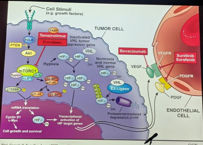 UroToday ESOU19 Revolution in the First Line Treatment mRCC