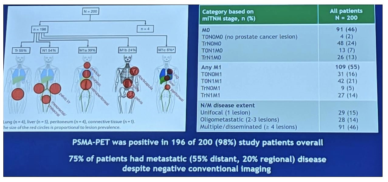 ASCO 2019 psma pet