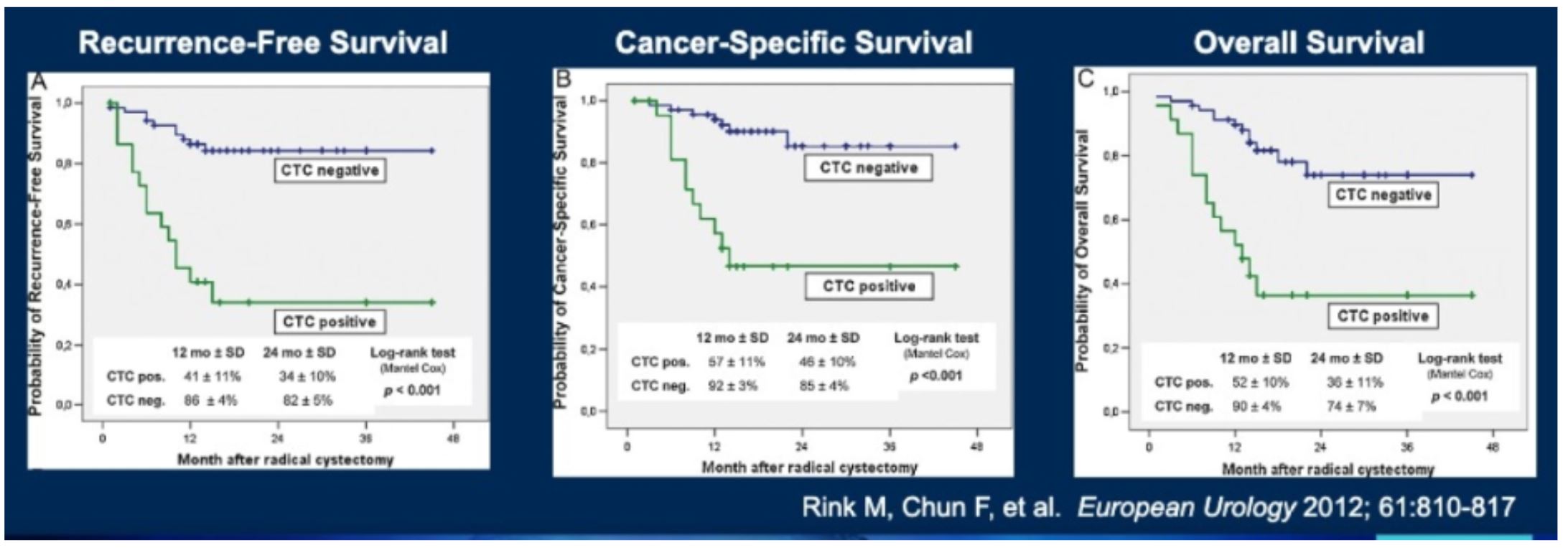 ASCO GU 2020 Figure 3 CTC prior to radical cystectomy