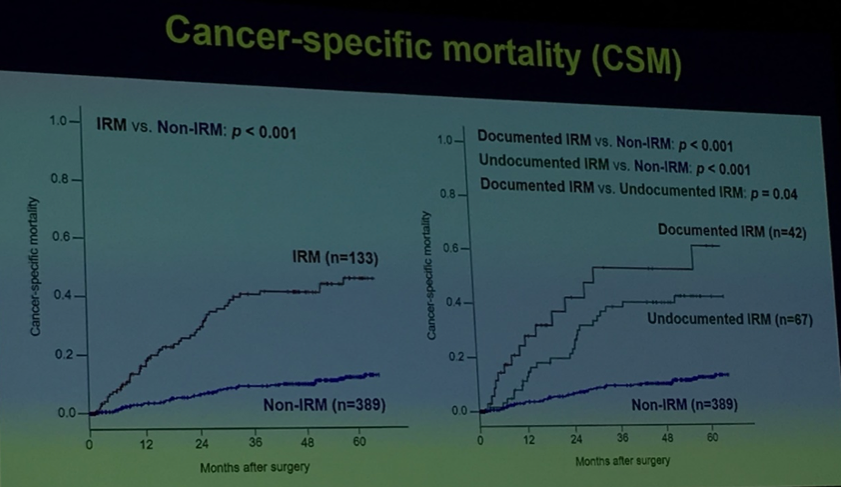 AUA2019_UroToday_Significance of Radiologically Undocumented Infiltrative Renal Masses _3 .png