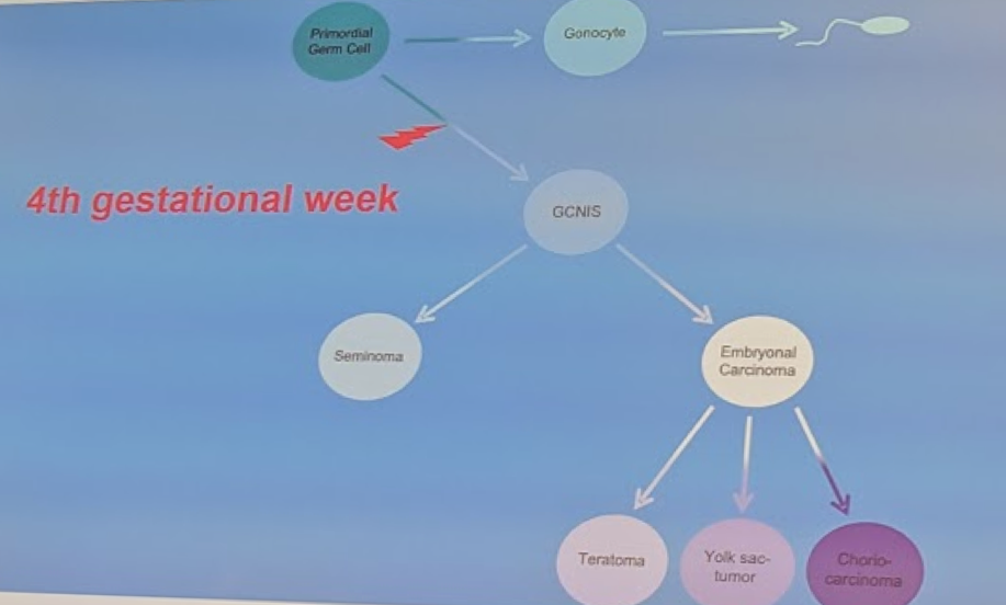 EAU2019 UroToday Testicular Dysgenesis Syndrome 1a