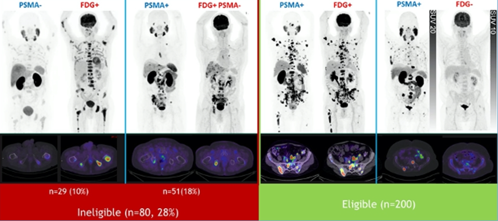 EAU2020_PSMA-targeted_Radioligand_Therapy_8.png