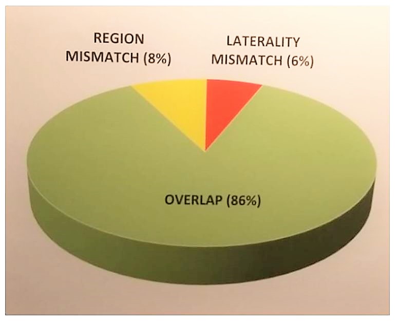 EAU 2019 fig 1 rate btwn biopsy and RP