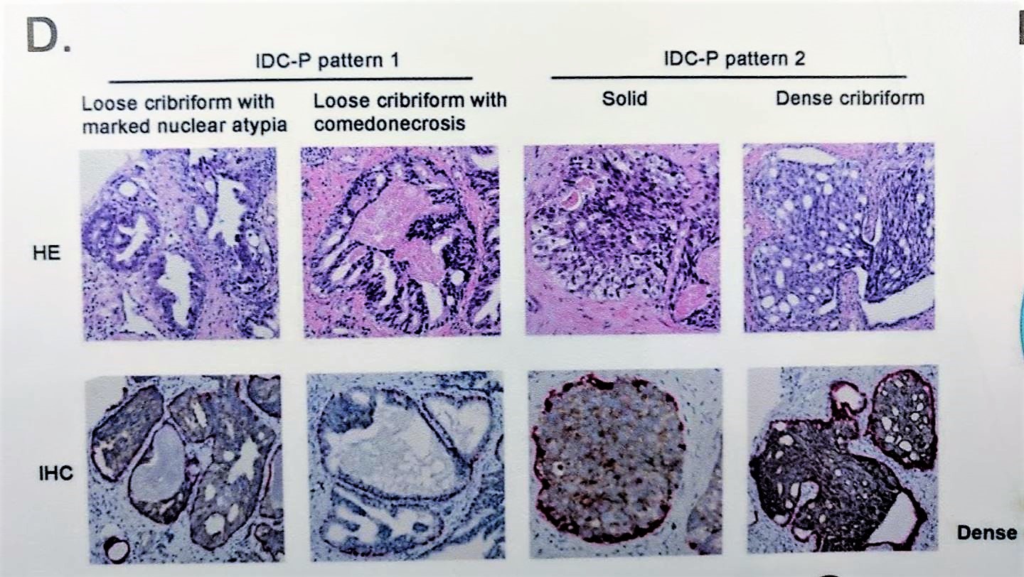 ESMO 2018 IDC stain