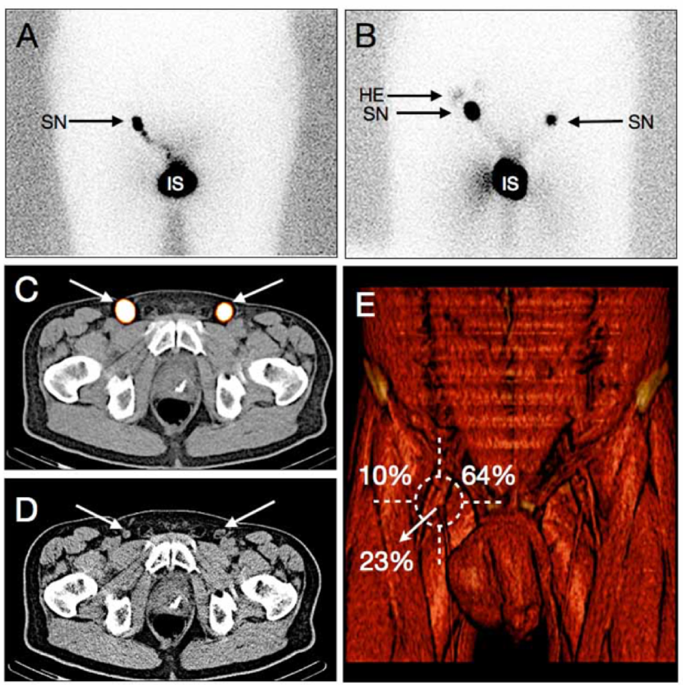 ESOU_SPECT-CT.png