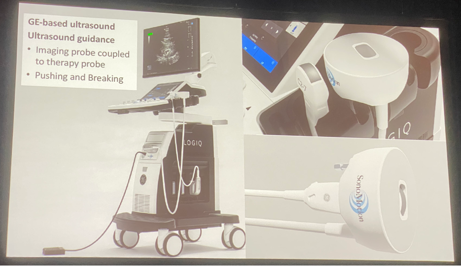 Figure_3._Ultrasound-based_urolith_fragment_relocation_and_burst-wave_lithotripsy.jpeg