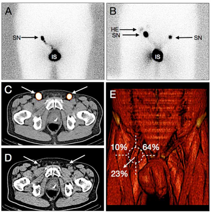 GSRGT_SPECT-CT.png