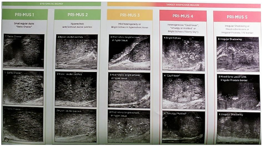 PRIMUS protocol for the high resolution micro ultrasound