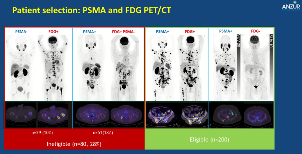 PatientSelection_theraP_ASCO2020.png