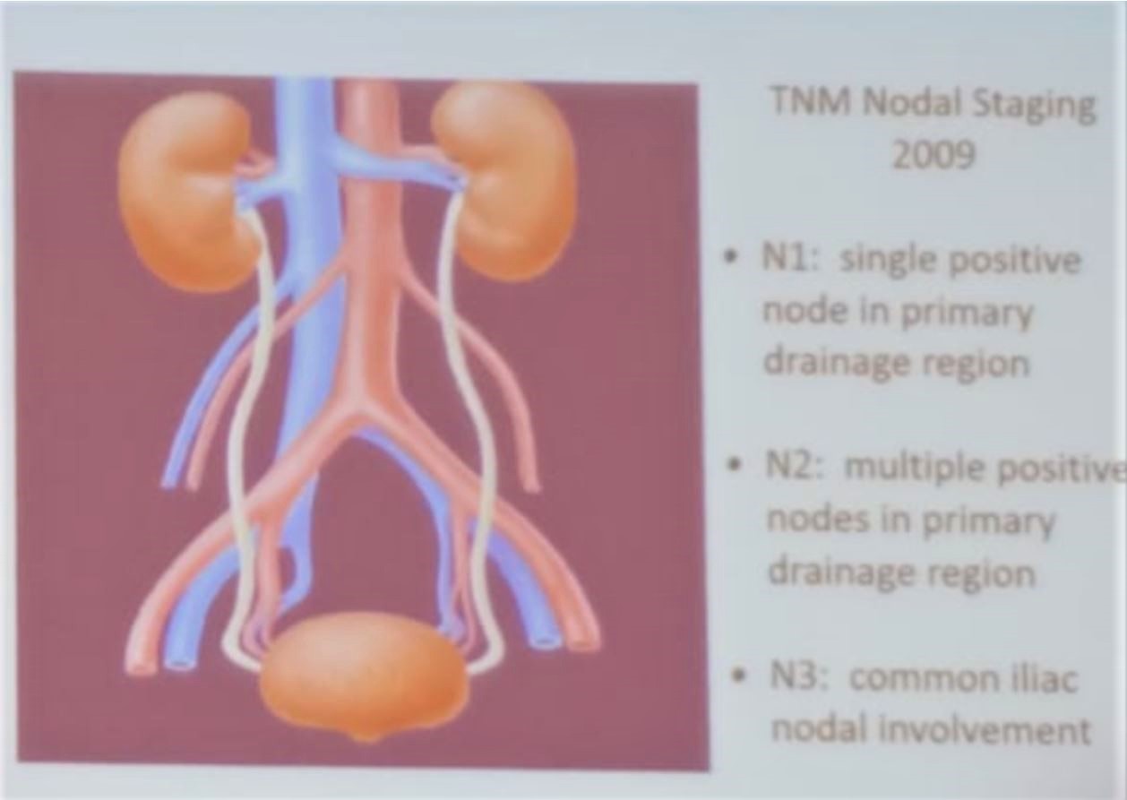 SIU 2019 Lymph node TNM staging