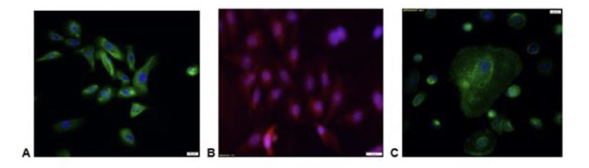 SUFU20_Immunohistochemical_staining.png