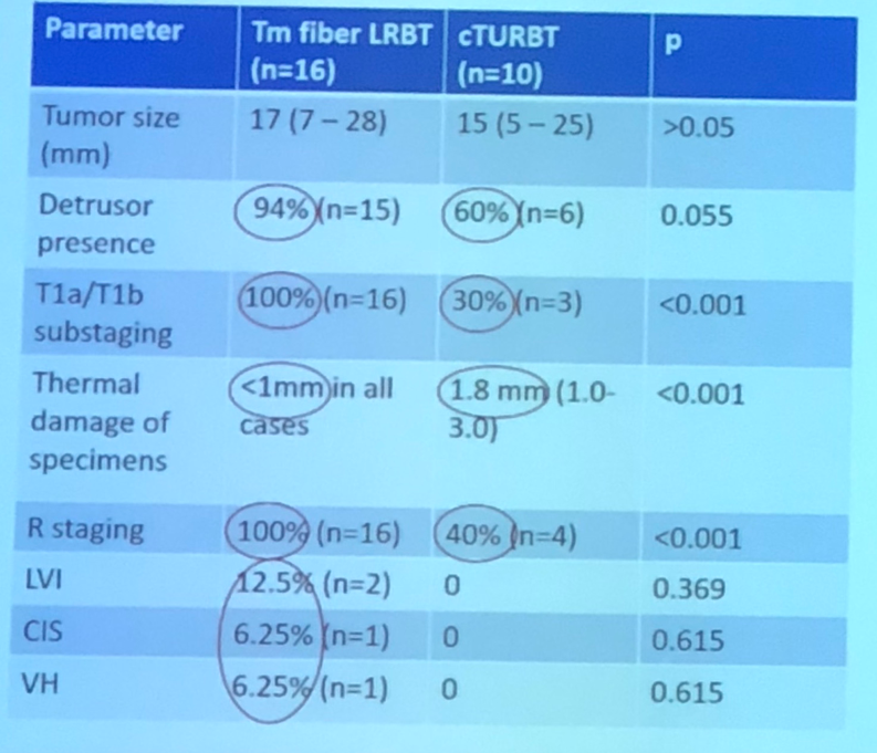 UroTodayWCE2018 Laser Thulium En Bloc and Conventional Transurethral Resection of Bladder Cancer 2