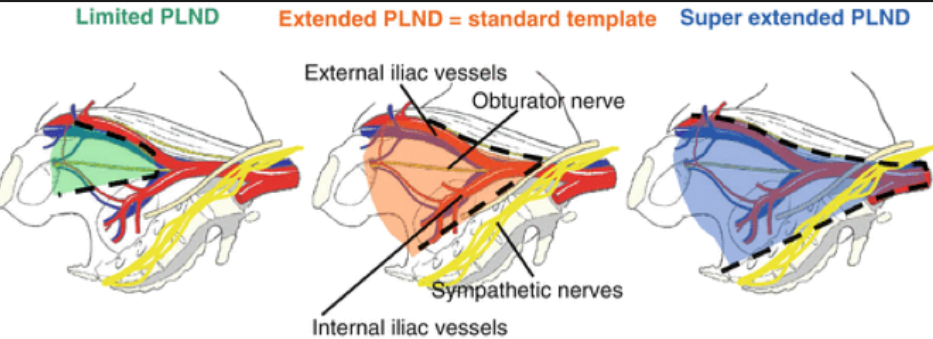 Erus 2018 Lymph Node Dissection Extended Is Enough Or Is Super Extended Mandatory