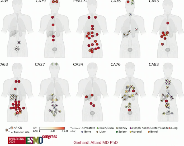 UroToday_ESMO24_Attard_2.png