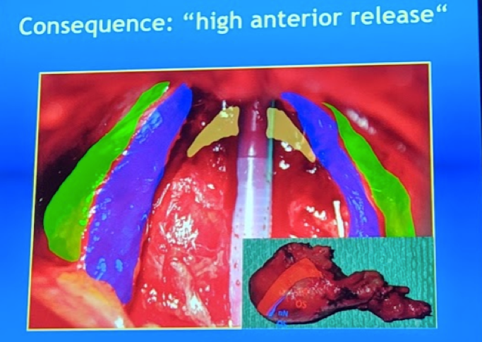 UroToday ESOU19 Optimizing functional outcomes in radical cystectomy 3