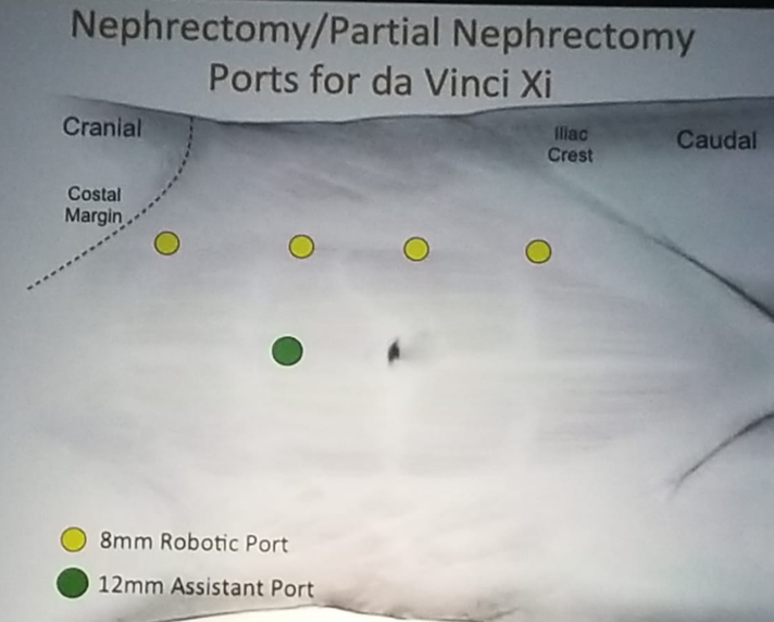 NARUS 2019: Port Placement Principles for Xi and Si Robots