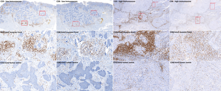 big-Figure_4_immunoscore.png