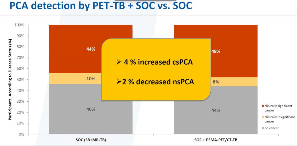 pca detection.jpg