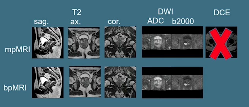 mp vs bp mri.jpg