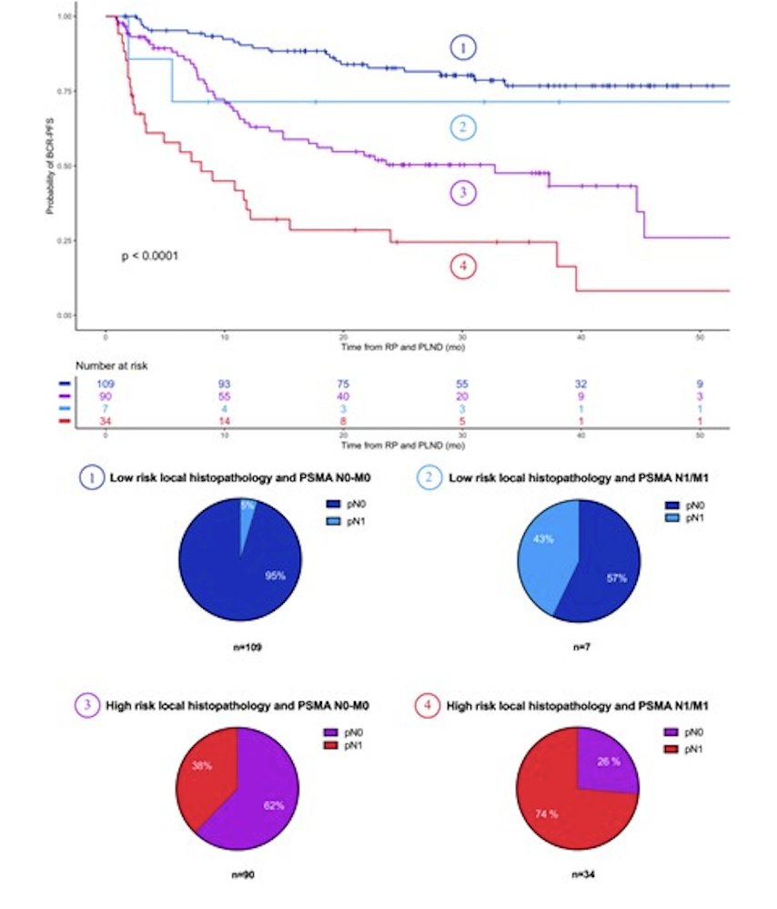 68Ga-PSMA-11 PET graphs