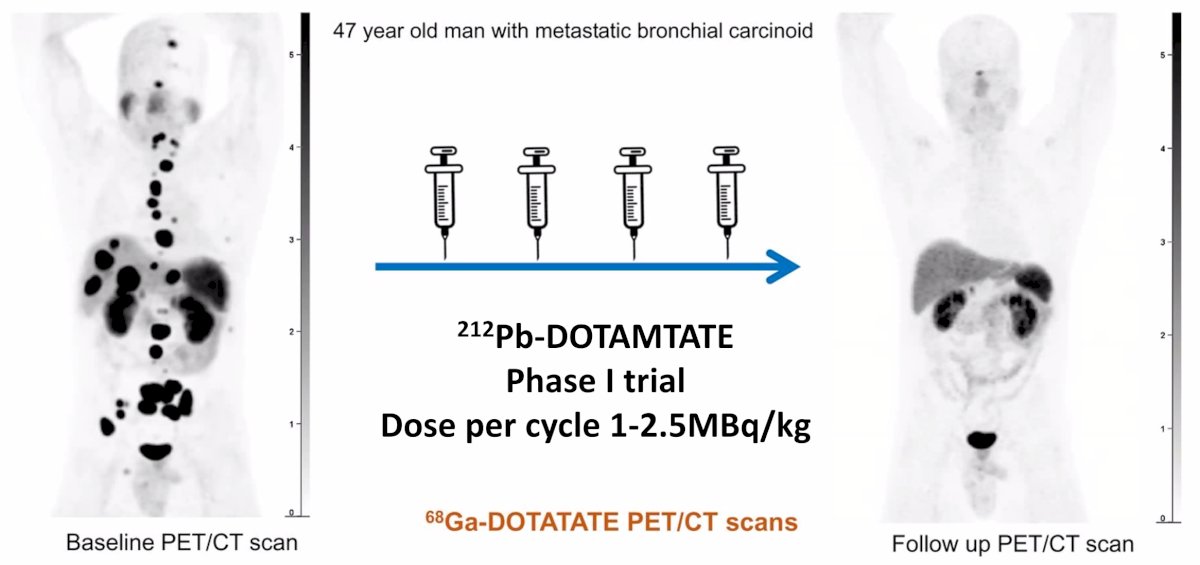 dotamtate