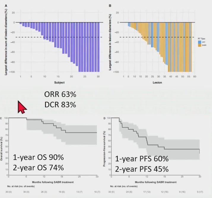 pfs comparison