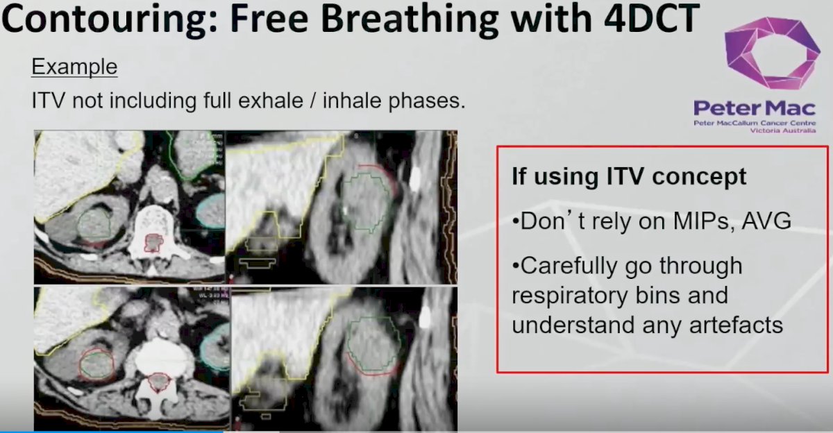 free breathing with 4dct