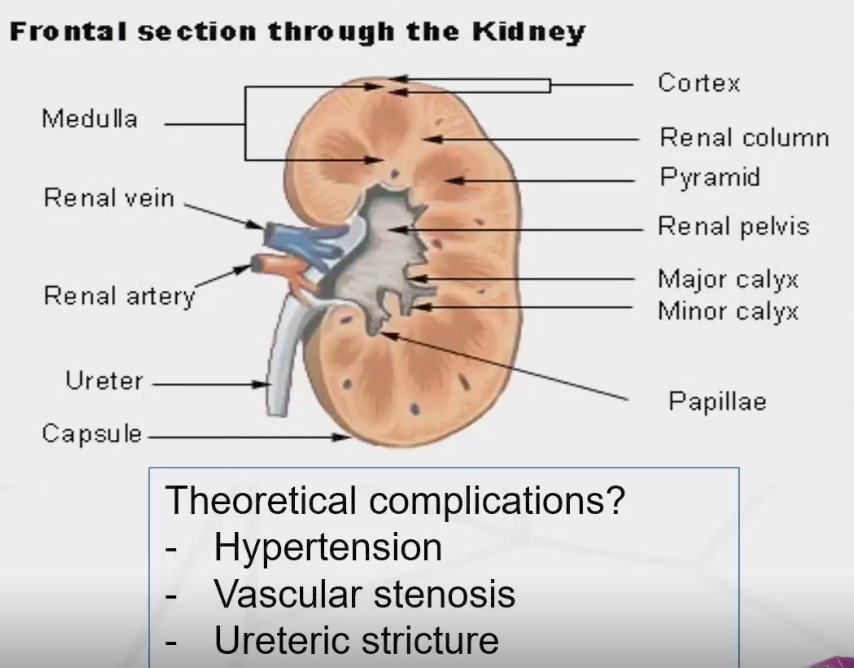 kidney diagram