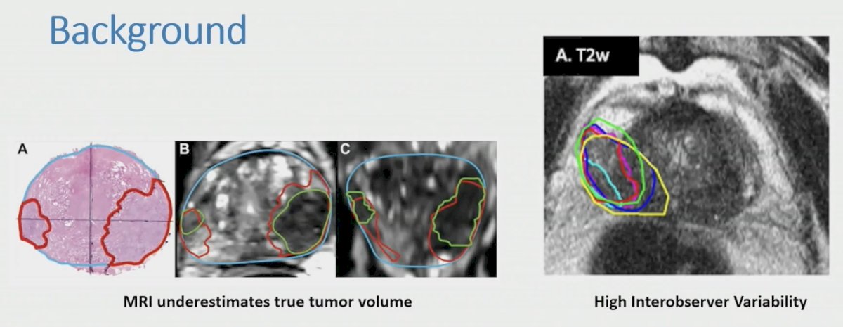 interobserver images