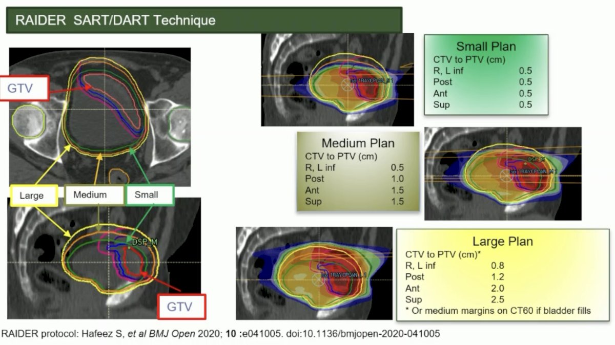 ESMO 2023 Huddart bladder preservation_8