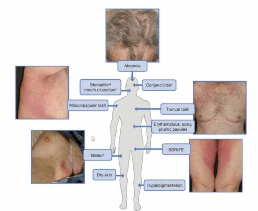 ESMO 2023 Loriot FGFR-directed therapies_3