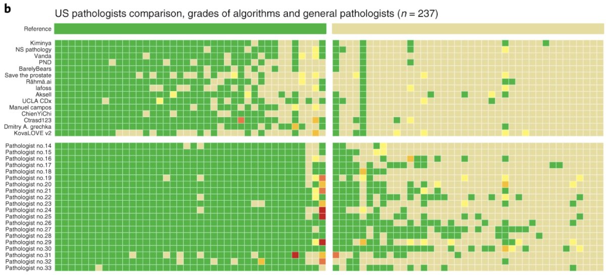 prostate cancer pathological comparisons