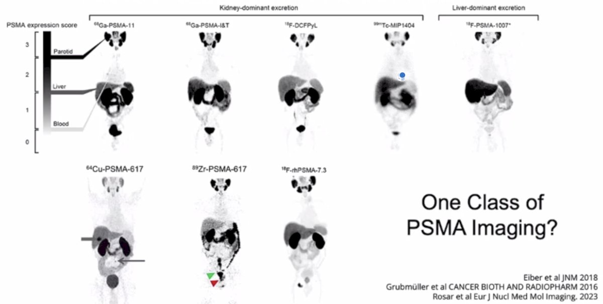 PSMA examples