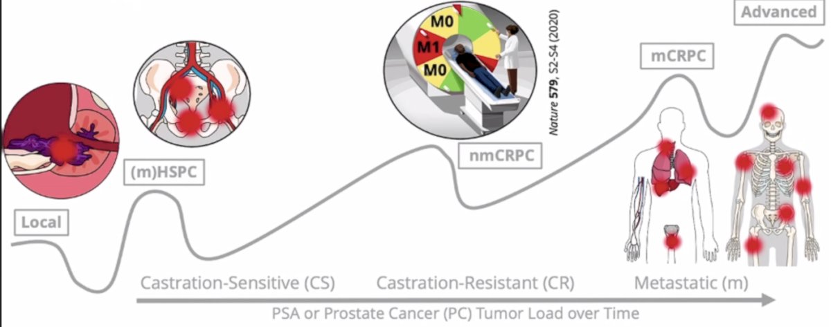 prostate cancer disease states