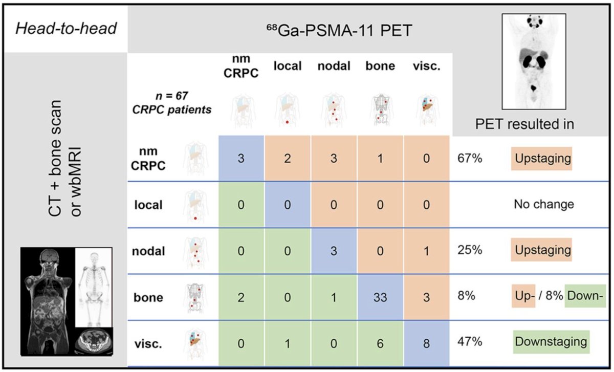 conventional imaging and 68Ga-PSMA-11 PET/CT, PSMA PET CT