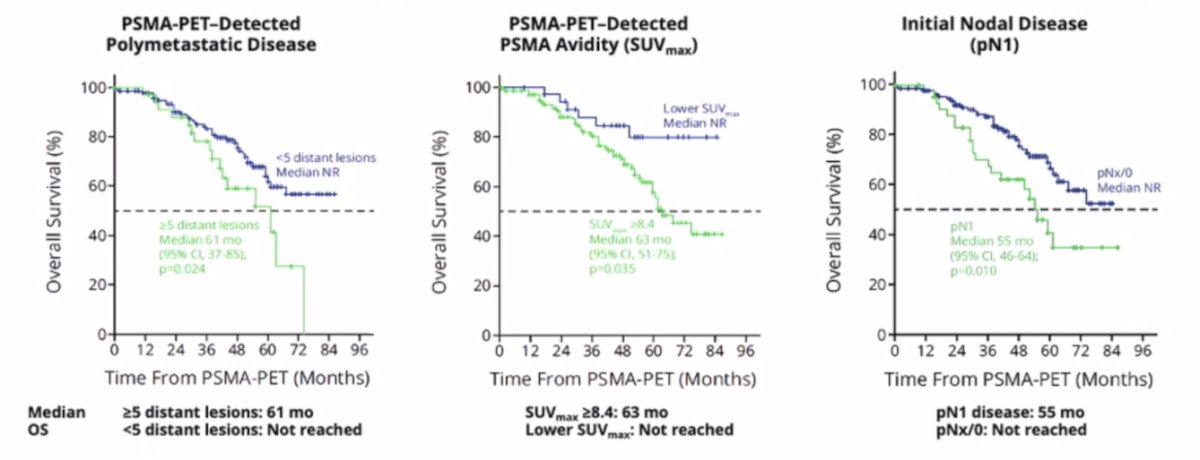 polymetastatic disease, pN1, and high PSMA avidity are associated with shorter overall survival for patients with nmCRPC