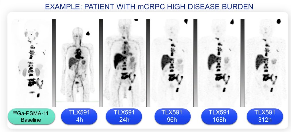 ASCO GU 2024_ ProstACT GLOBAL_0