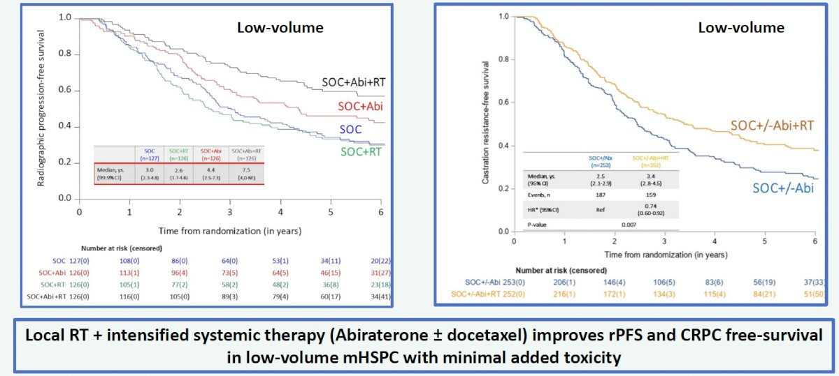 addition of prostate radiotherapy to standard of care + abiraterone acetate was associated with a significant radiographic progression-free survival