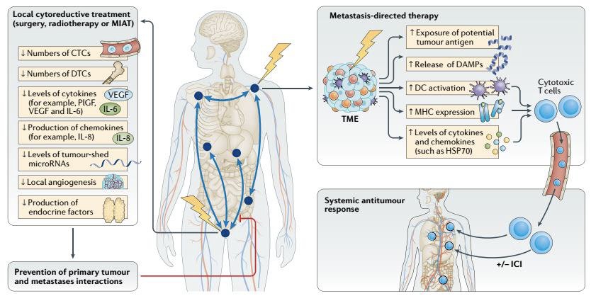 ‘comprehensive’ radiotherapy