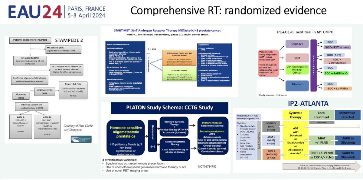 comprehensive radiotherapy