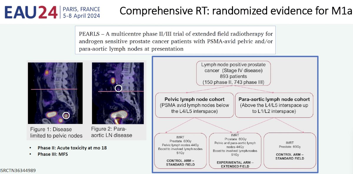 comprehensive’ radiotherapy 2 m1a
