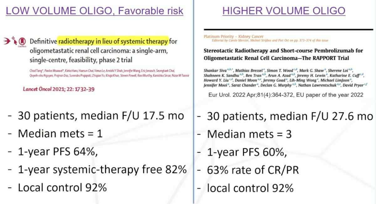 assessing stereotactic ablative radiation therapy (without systemic therapy) in low volume, oligometastatic, favorable risk patients