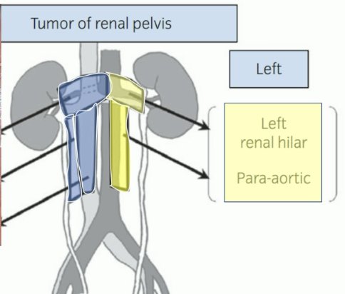 high-risk patients undergoing a radical nephroureterectomy should be considered for a concurrent lymphadenectomy, with the template varying by the tumor location