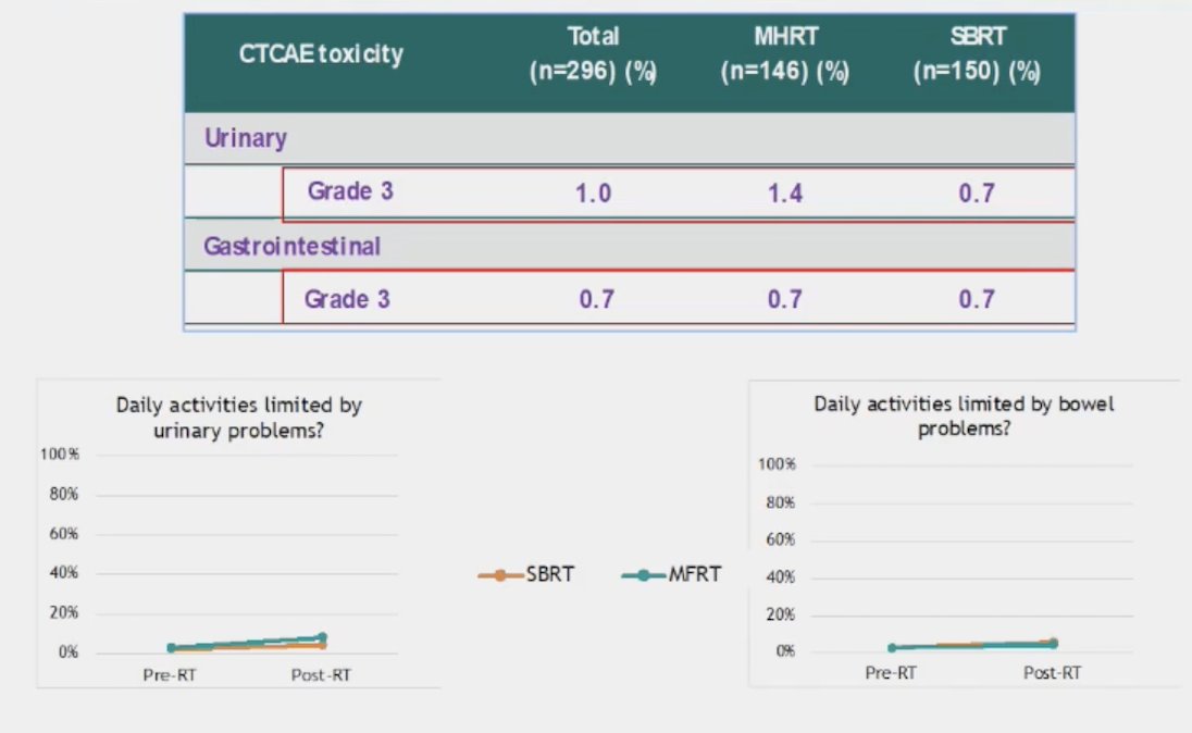 analysis of prostate radiotherapy in high risk or N+ moderate versus extreme hypofractionation (PRIME), noting comparable Grade 3+ GU and GI toxic effects