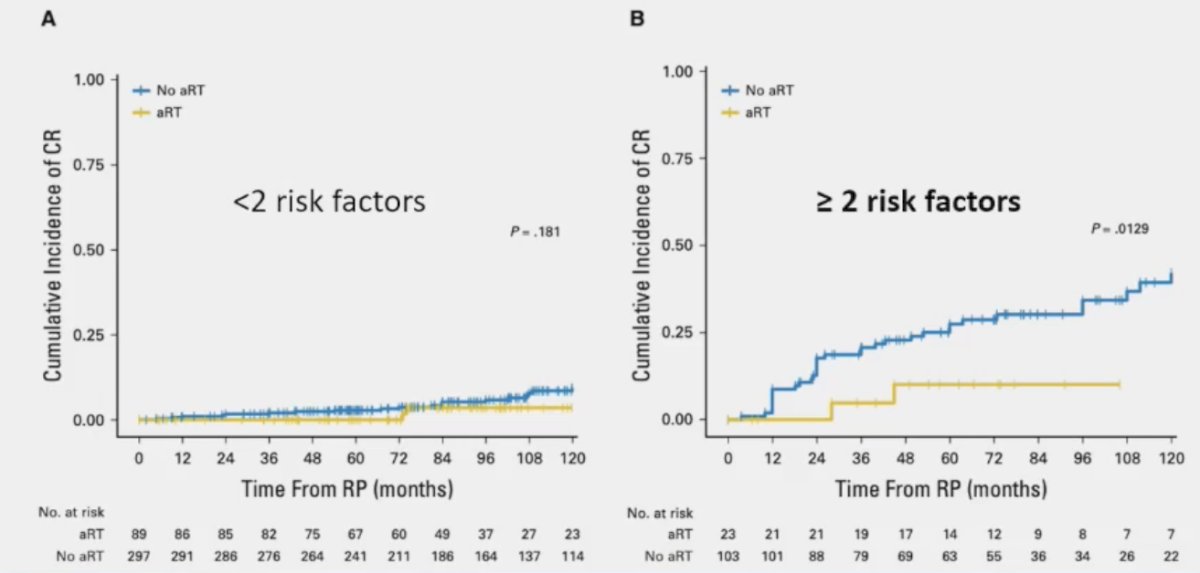Dalela et al. demonstrated in 2017 that patients with ≥2 of the following risk factors (pT3b-4, Gleason Score 8-10, lymph node invasion, and Decipher® score >0.6) were more likely to benefit from adjuvant radiotherapy.