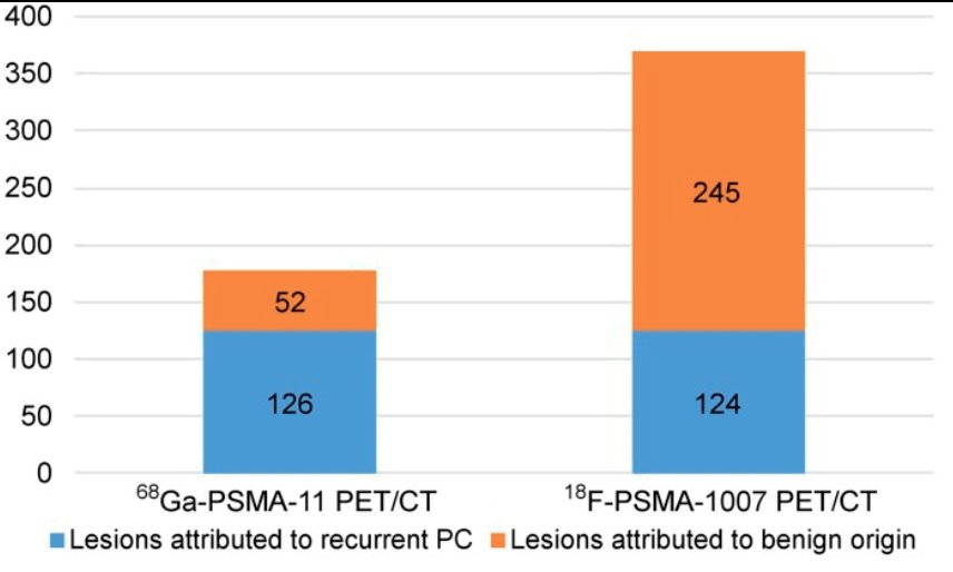 matched-pair comparison of 68Ga-PSMA-11 PET/CT and 18F-PSMA-1007 PET/CT to assess the frequency of pitfalls and detection efficacy in biochemical recurrence after radical prostatectomy