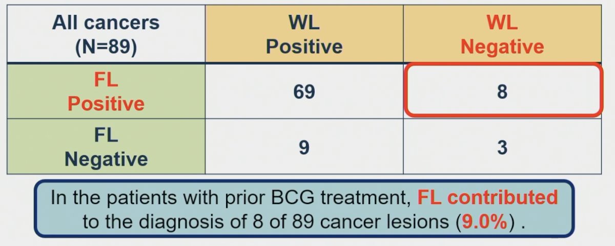 Among 308 lesions resected in patients with prior BCG treatment, 89 (29%) were positive for malignancy. In these patients, use of fluorescence cystoscopy contributed to the diagnosis of 8/19 cancerous lesions (9%).