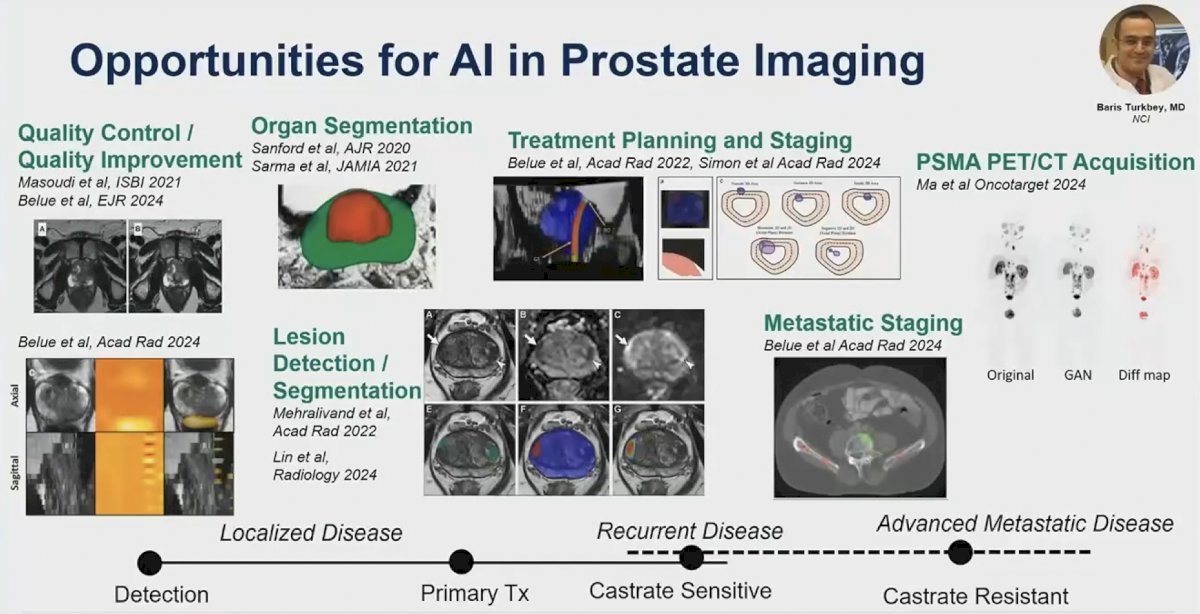 ai for prostate cancer imaging